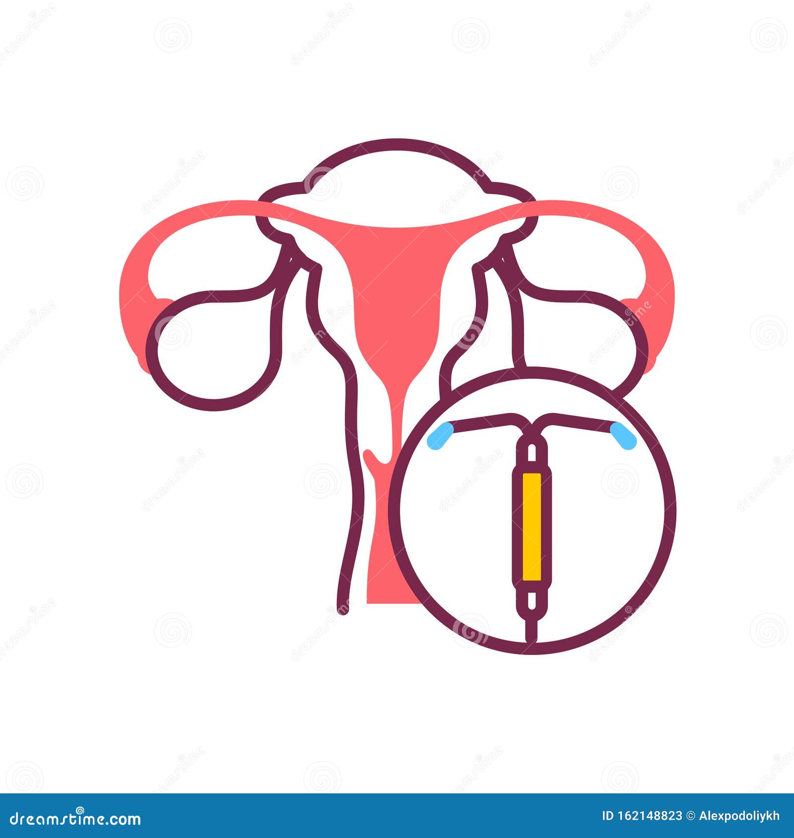 During sex iud What Sex