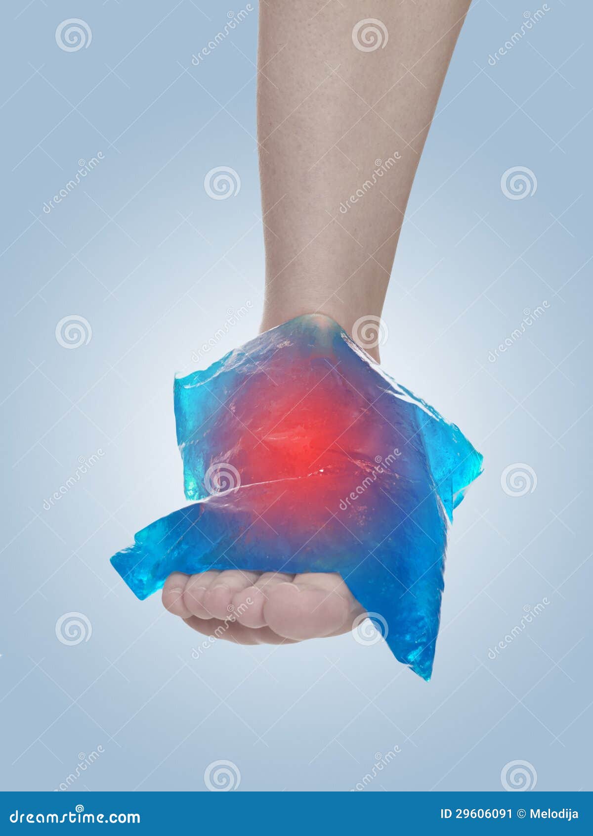 Cool Gel Pack on a Swollen Hurting Ankle. Stock Image Image of human