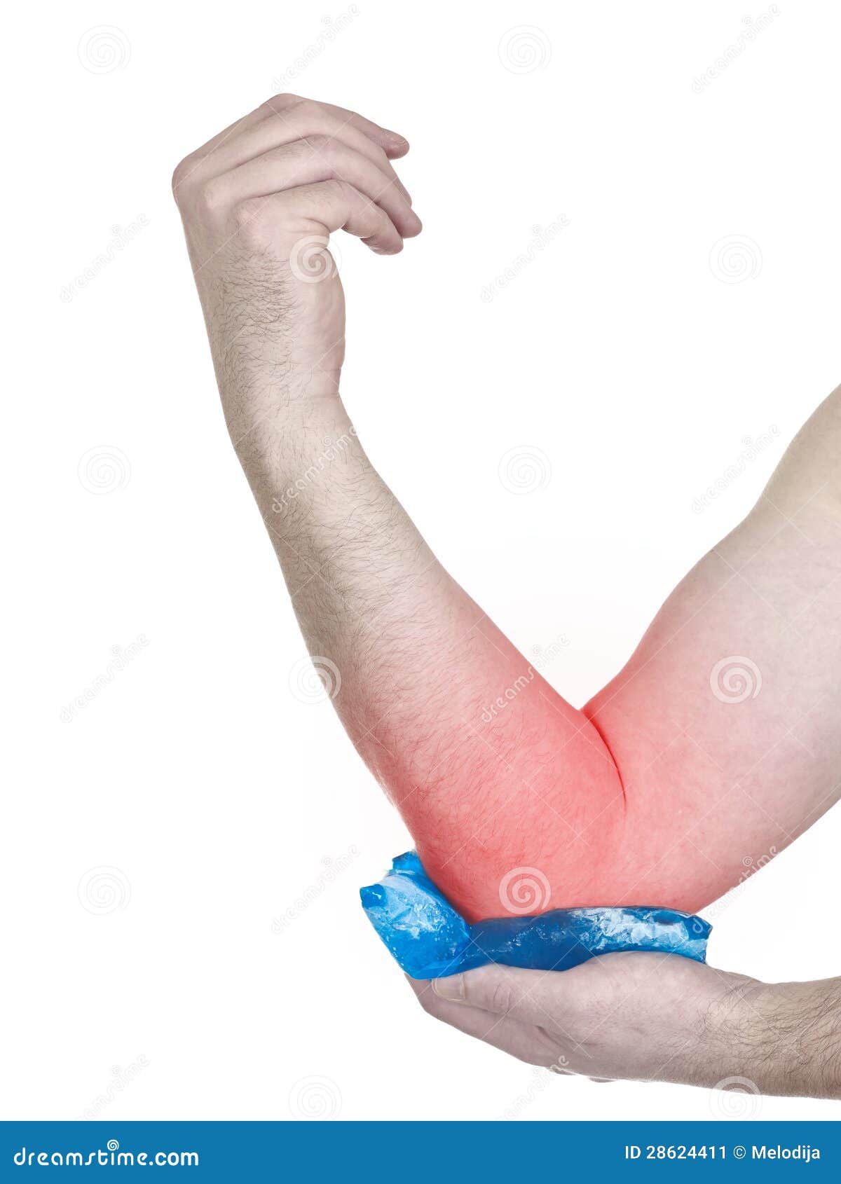 Cool Gel Pack on a Swollen Hurting Elbow. Stock Image Image of copy