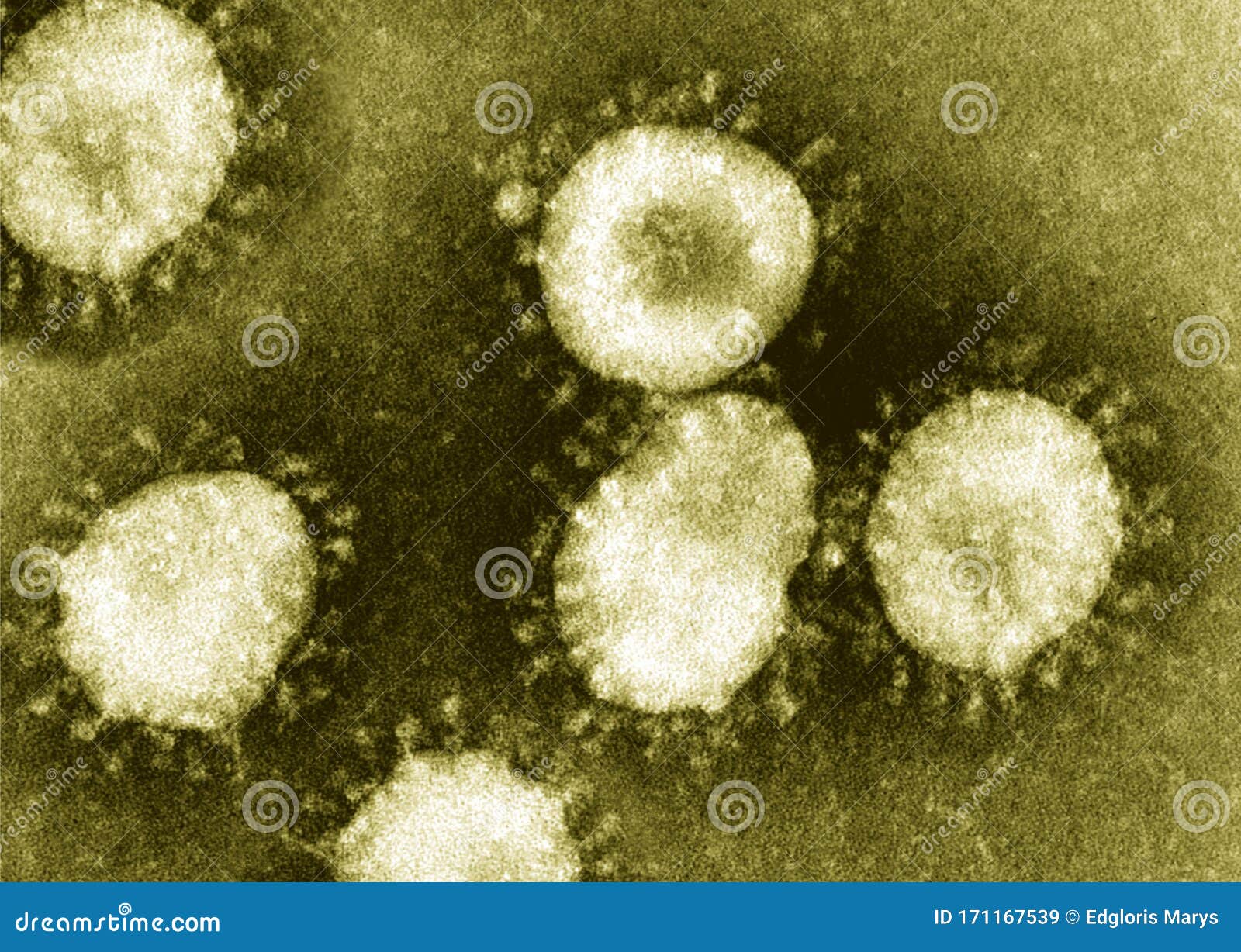 detail of ultraestructure of deadly coronavirus particles under transmission electron microscopy tem