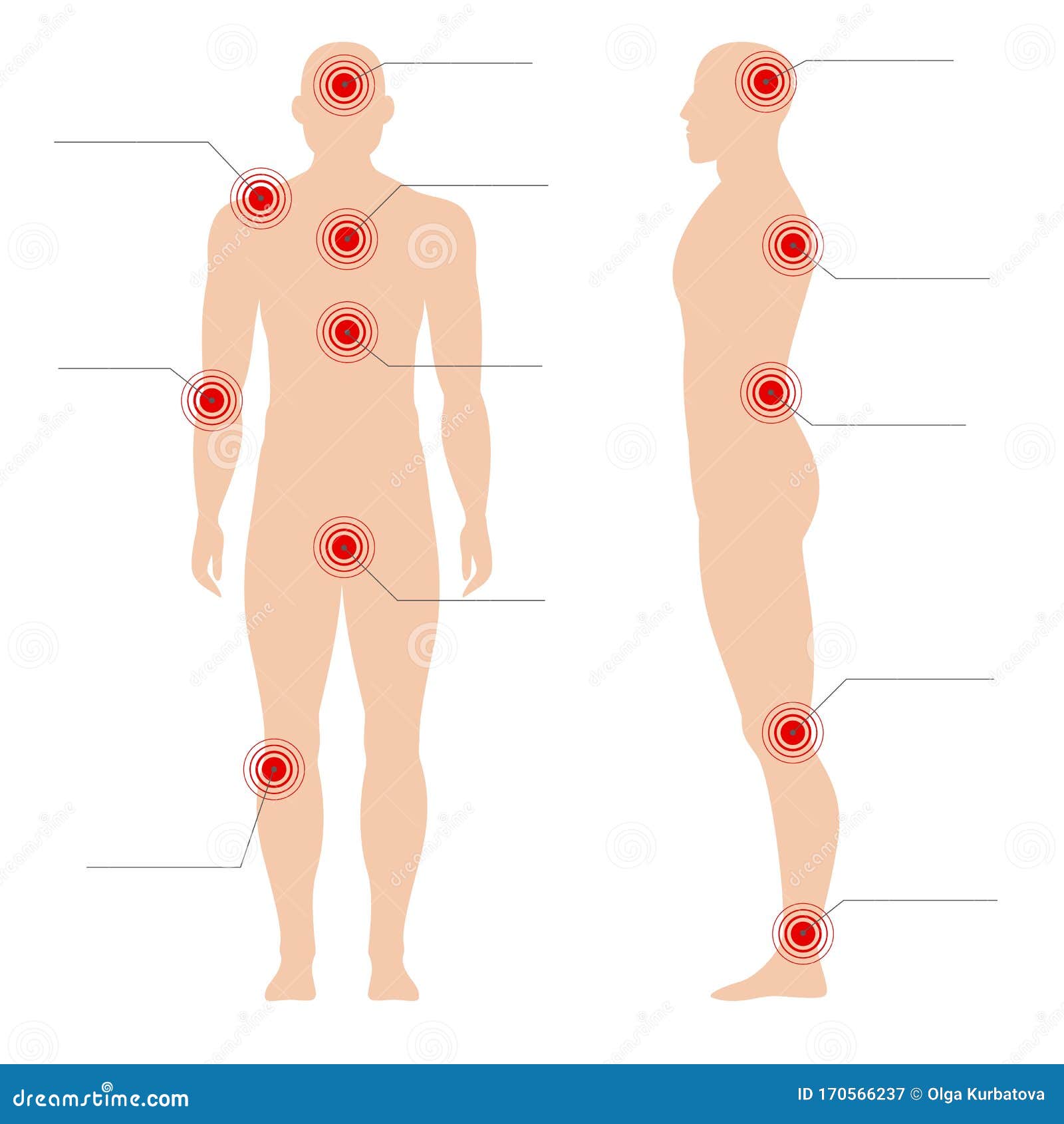 Corps D'homme Avec Des Points De Douleur. Point Rouge Douloureux ...