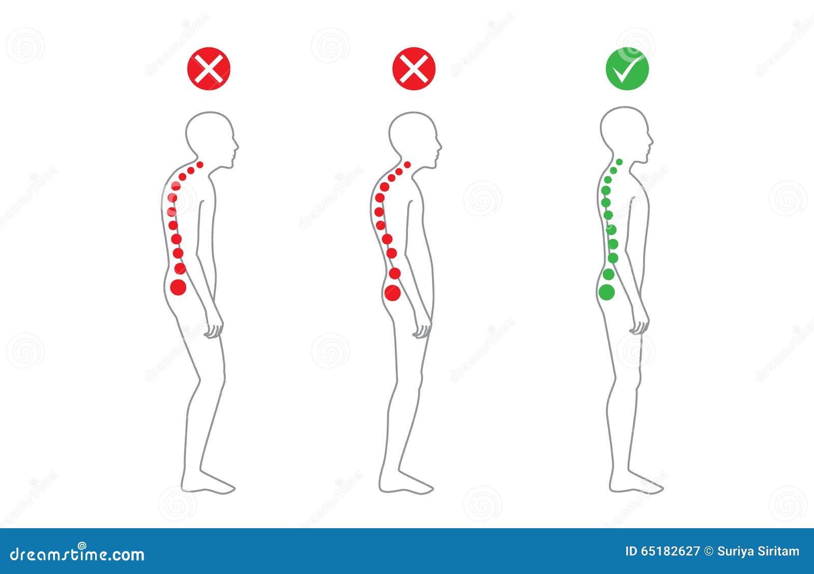 correct alignment of body in standing posture