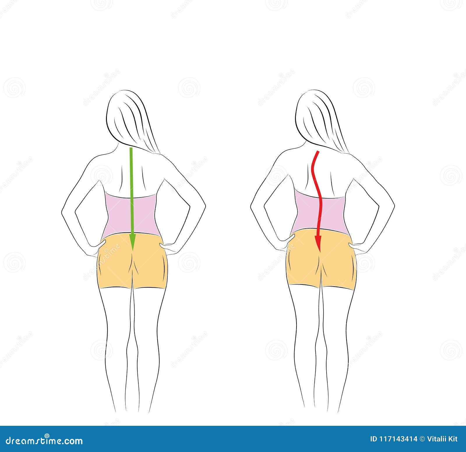 Correct Alignment of Human Body in Standing Posture for Good ... Biology Diagrams