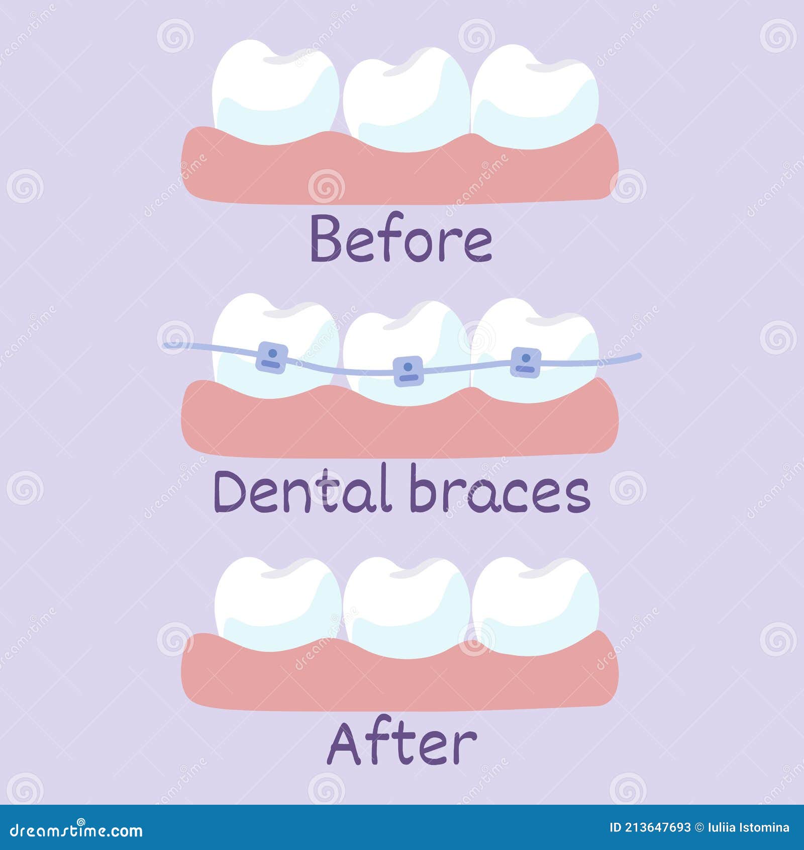 Brackets Flat Line Icons. Brace Vector Illustrations. Thin Signs Of