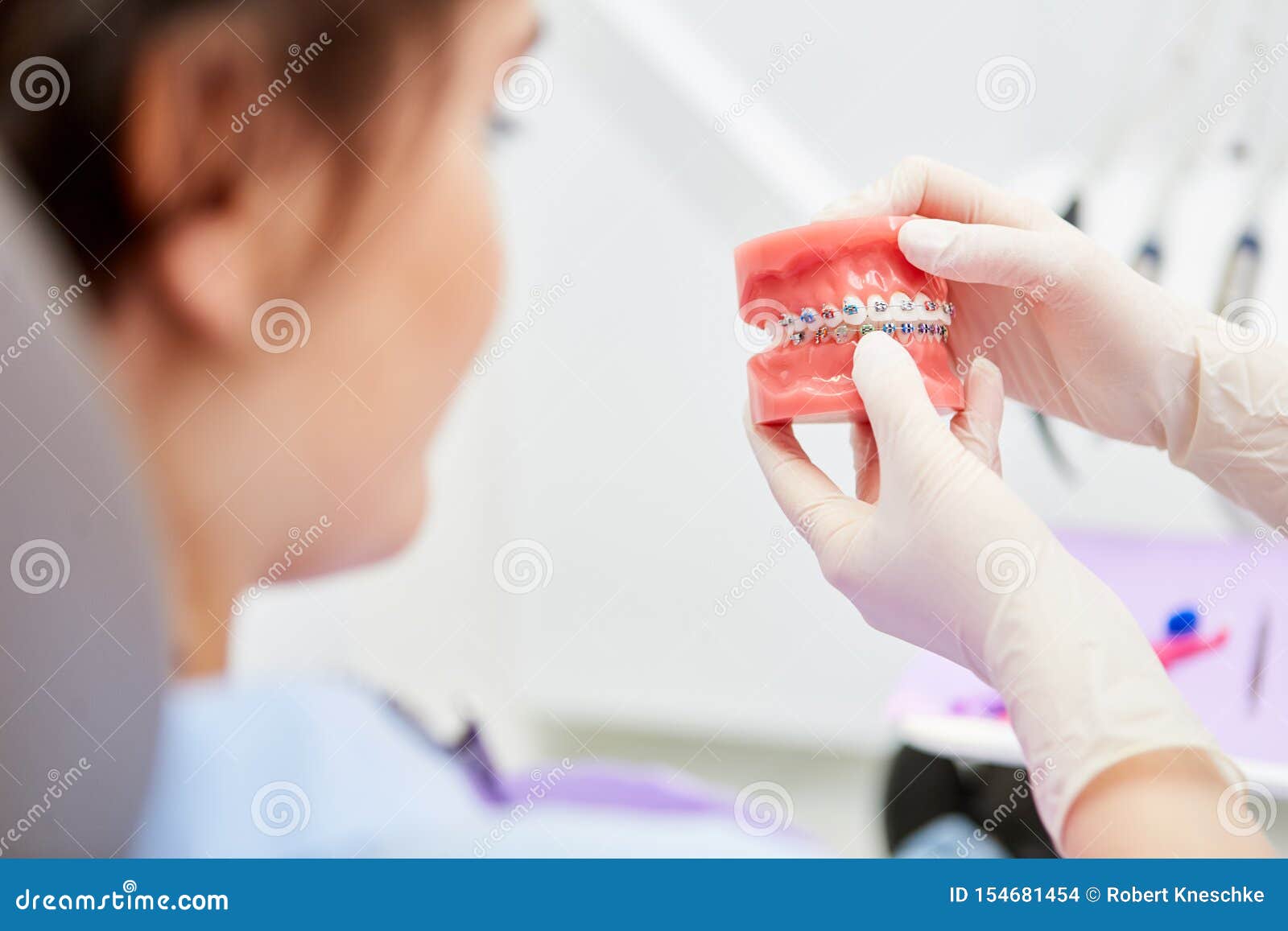 Correction of Tooth Misalignment by Braces Stock Photo Image of
