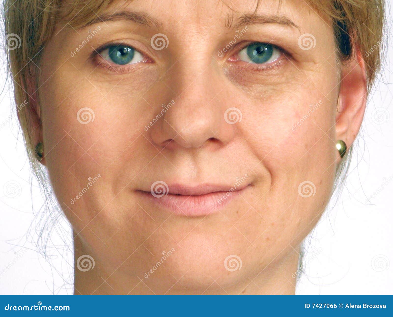 correction of wrinkles on half of face