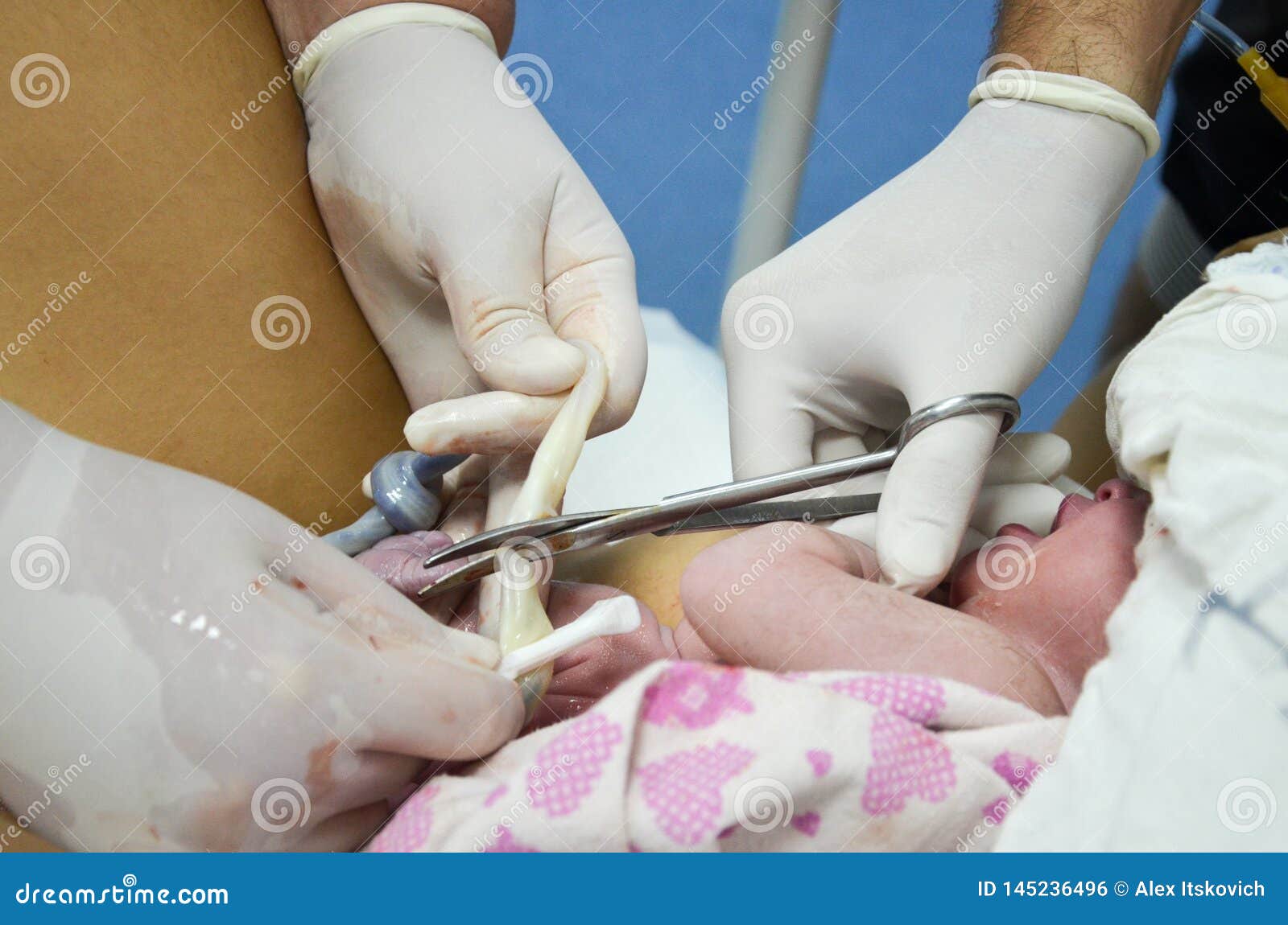 Cortar El Cordon Umbilical Entre Un Recien Nacido Y La Placenta Foto De Archivo Imagen De Bebe Cuidado Cortar El Cordon Umbilical Entre Un Recien Nacido Y La Placenta Foto De Archivo Imagen De Bebe Cuidado