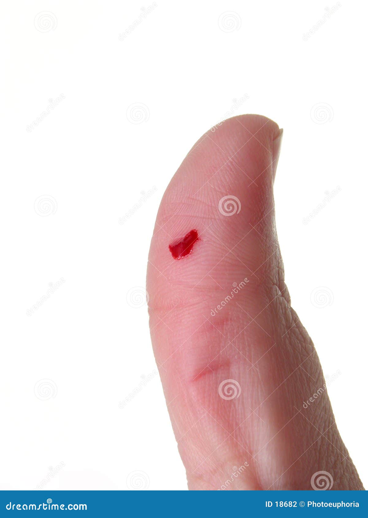 Corte O Dedo (2) Fotografia de Stock - Imagem: 18682
