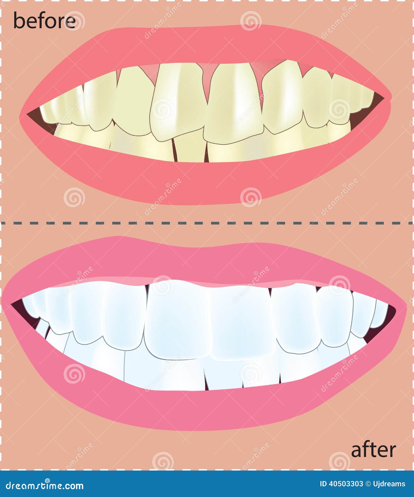Cosmetic Dentistry. Medical color illustration.