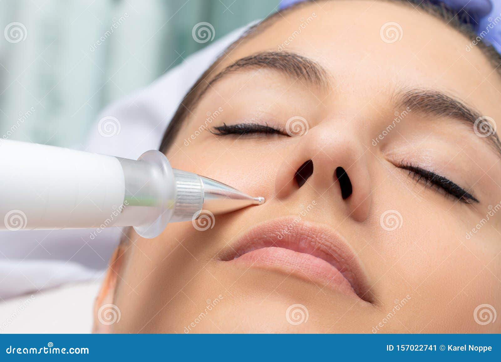 cosmetic laser pen reducing wrinkles on female face