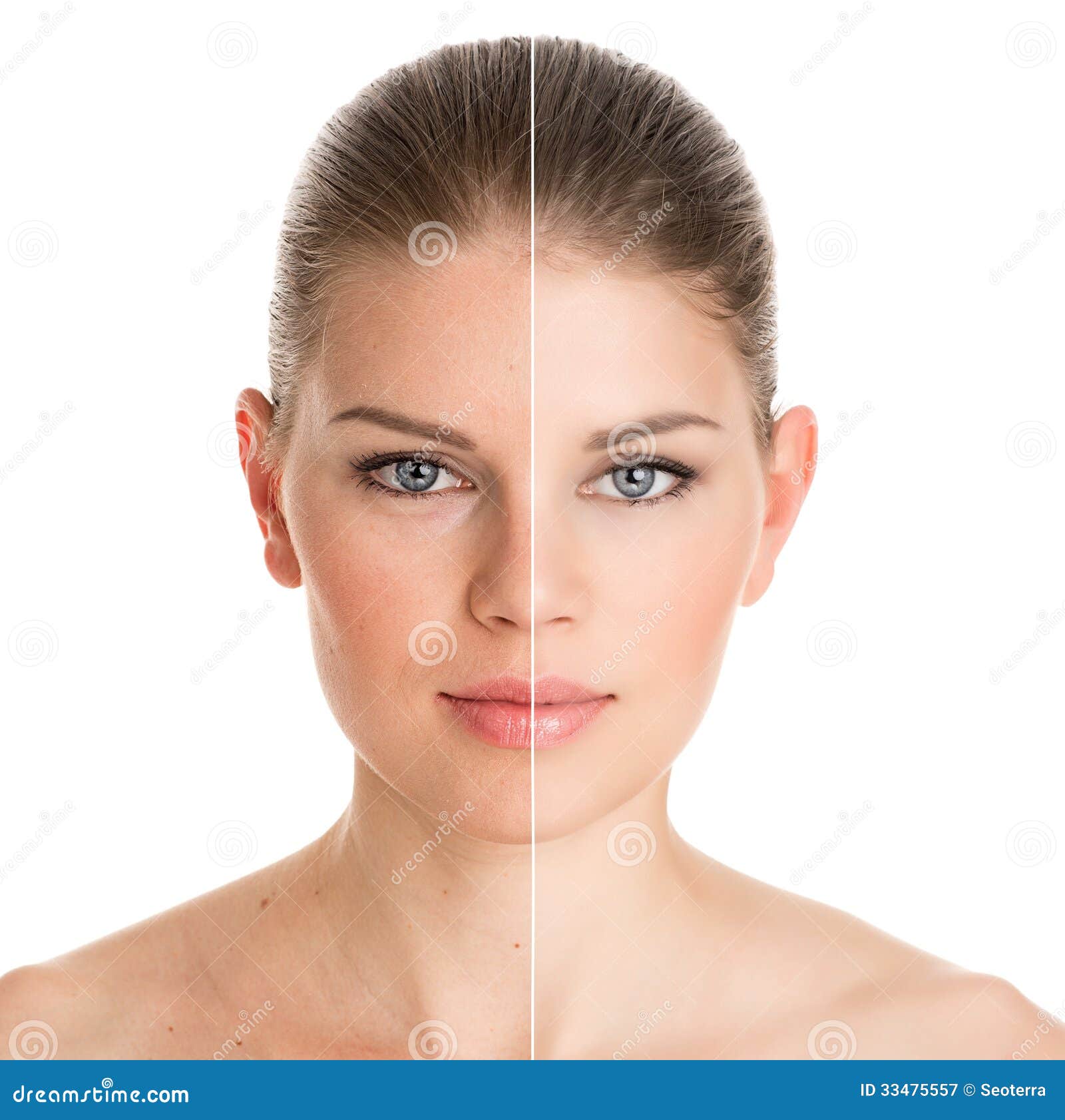 before and after cosmetic operation