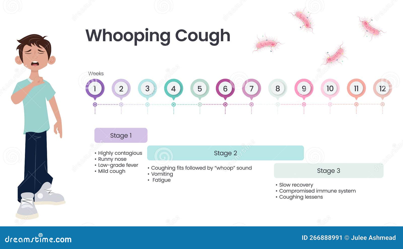 Whooping Cough Pertussis Symptom Timeline Vector Illustration whooping-cough-pertussis-symptom-timeline-vector-illustration