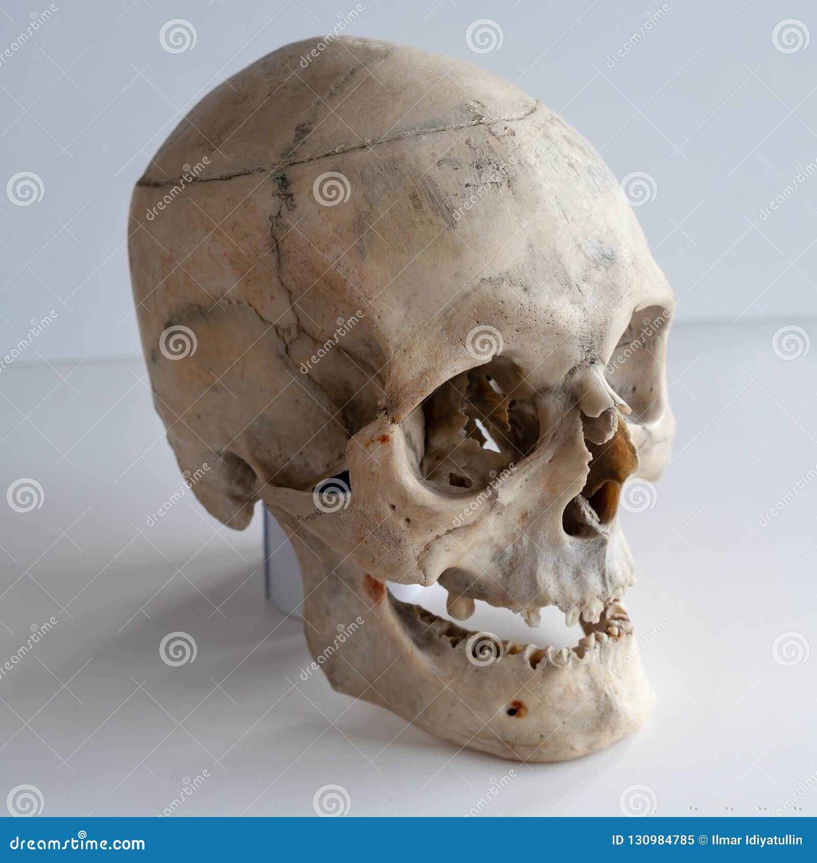 Cráneo Humano Real, Cierre Para Arriba Imagen de archivo - Imagen de  esqueleto, esquelético: 130984785, image size:1600x1690