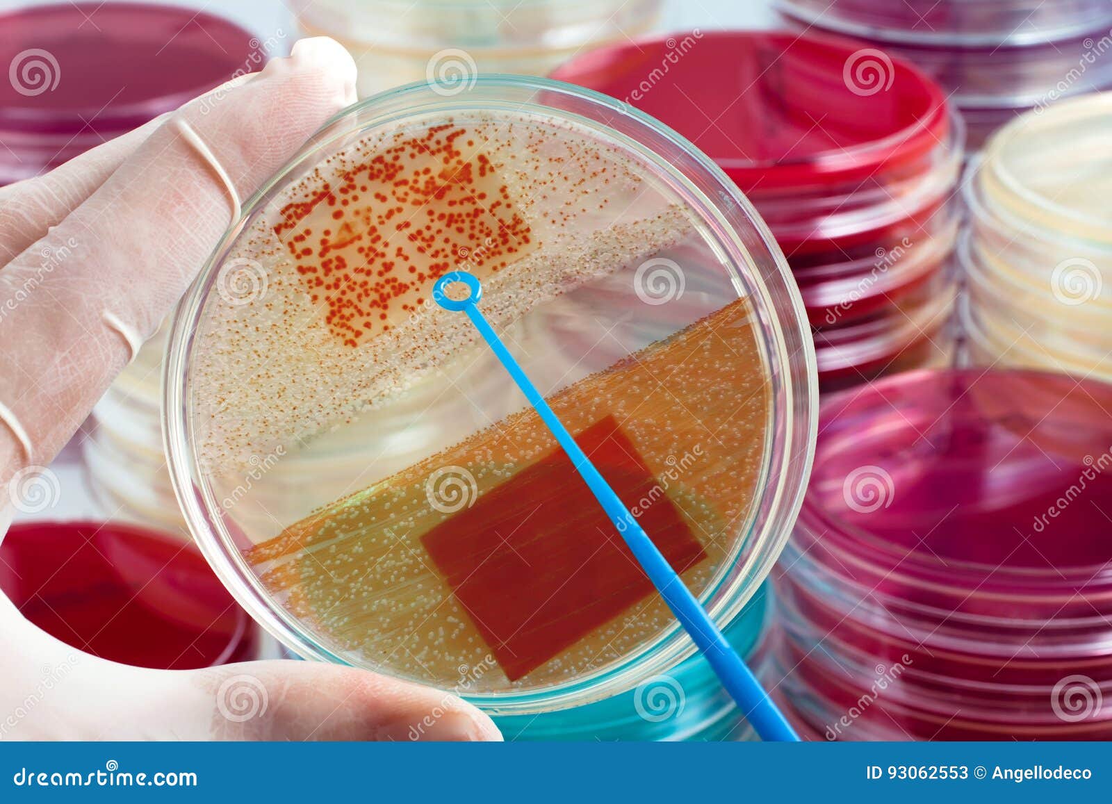 Crecimiento De Colonias De Bacterias En Placa Del Medio De Cultivo ...