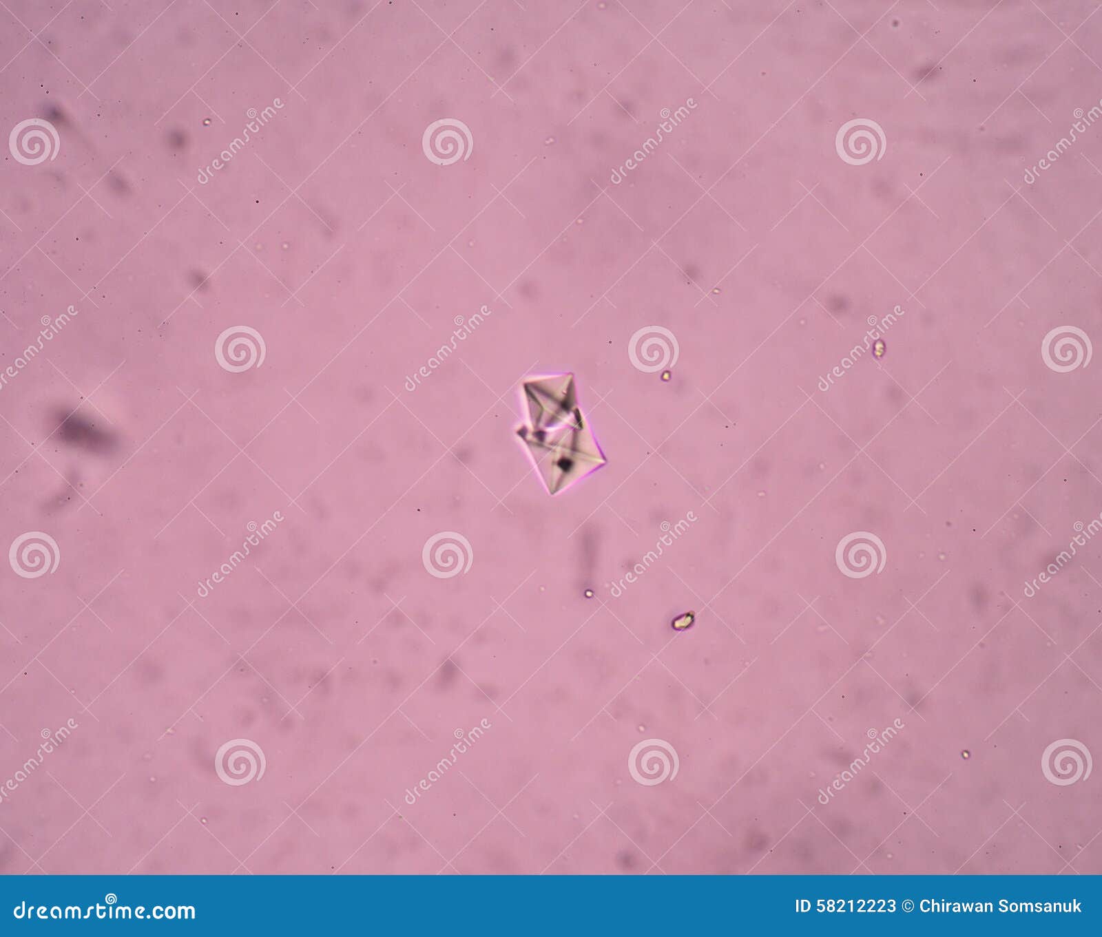 Cristal D Oxalate De Calcium Image Stock Image Du Forme Cristal 58212223