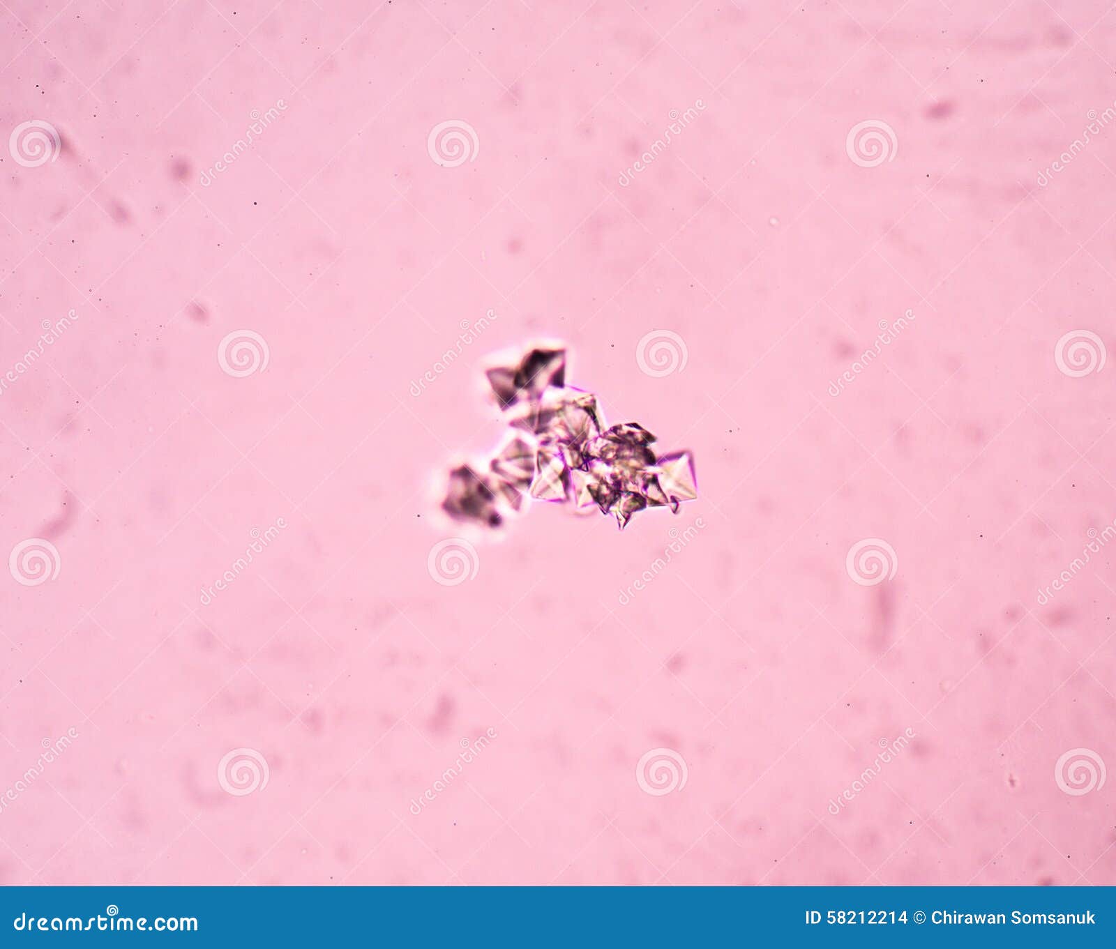 Cristallo Dell'ossalato Del Calcio Fotografia Stock - Immagine di