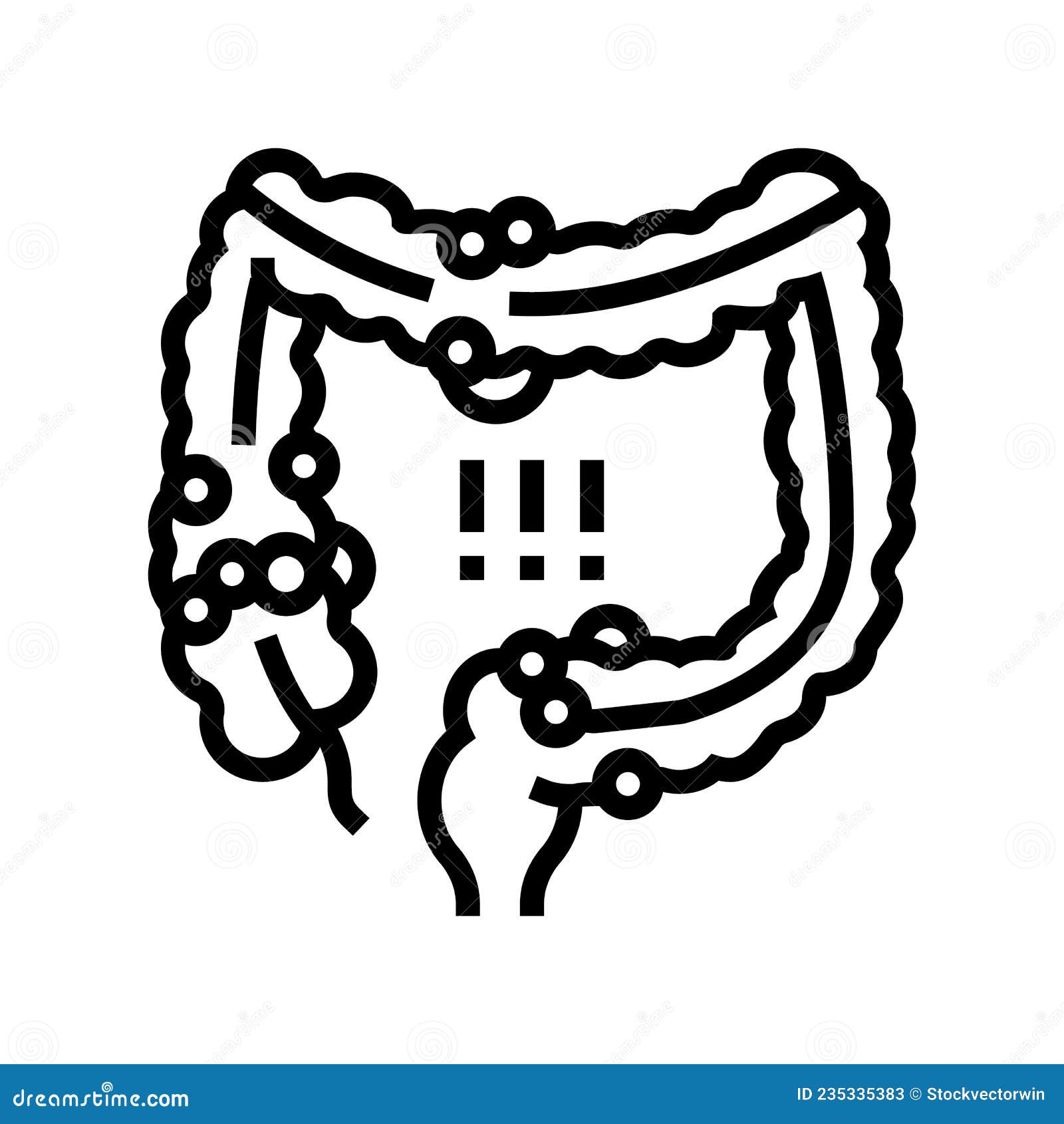 Crohns Disease Vector Illustration. Labeled Diagram With Diagnosis ...