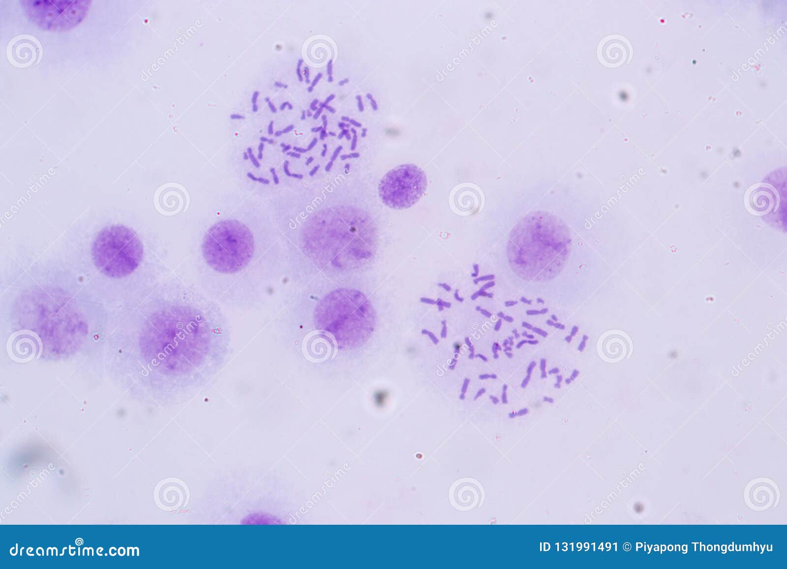 Cromosomas Humanos Debajo Del Para La Educación Imagen de archivo - Imagen de molecular, microscopio: 131991491