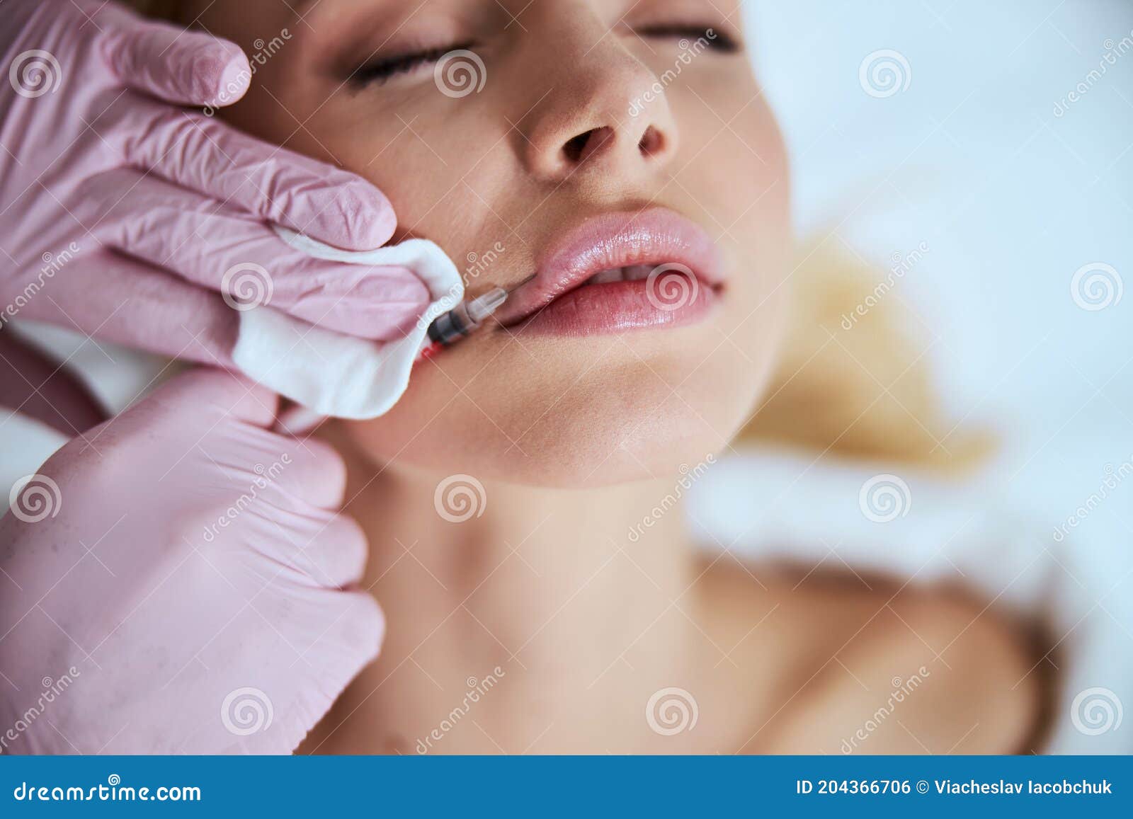 female patient undergoing the lip enhancement procedure