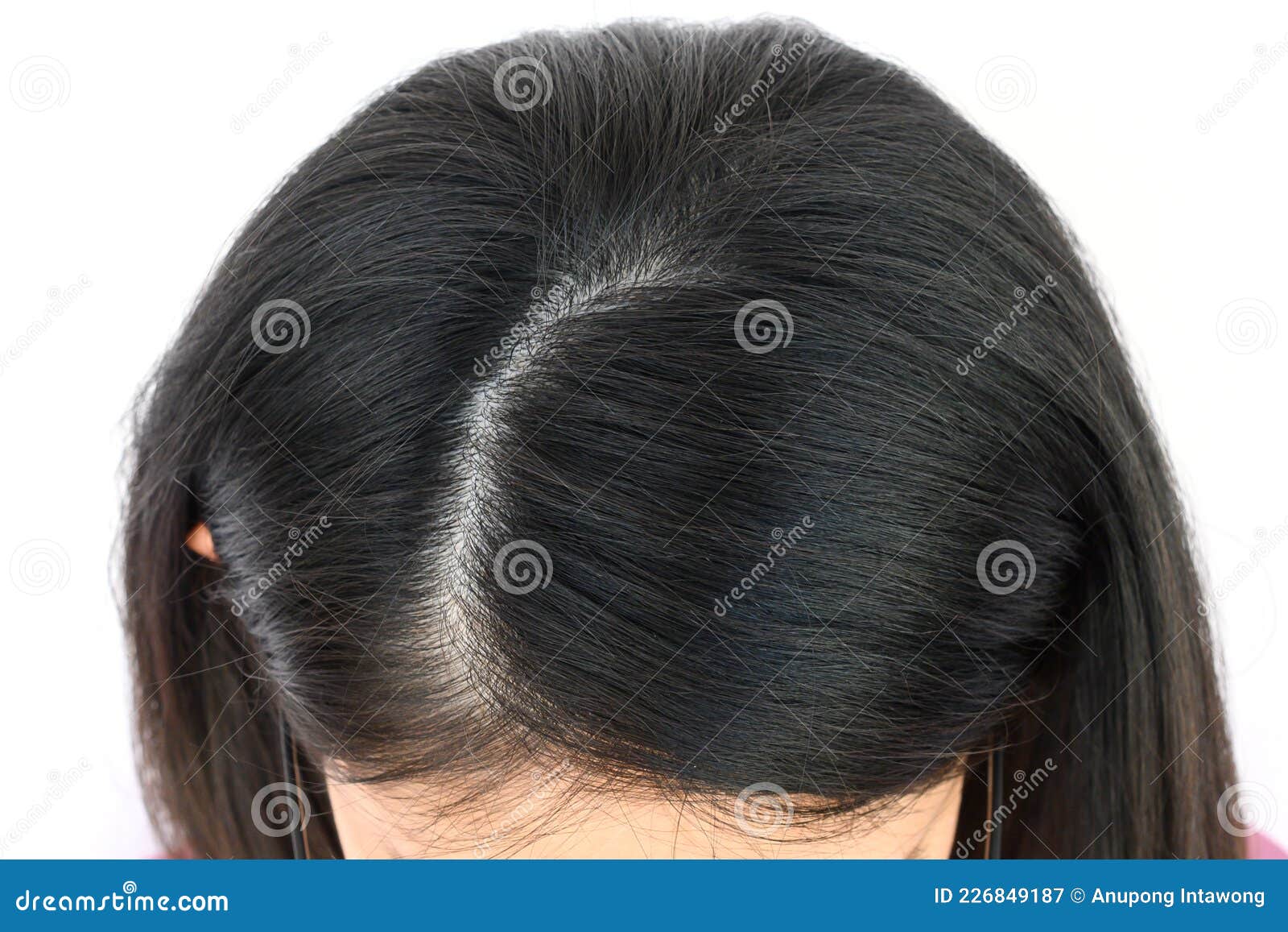 Cropped View of Woman Top`s Head with Part of Her Thin Hair, she Had Hair  Loss Problem. Stock Image - Image of asia, pattern: 226849187