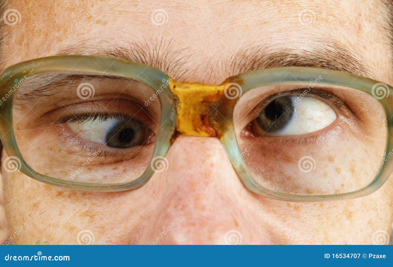 cross-eyed person in old-fashioned spectacles