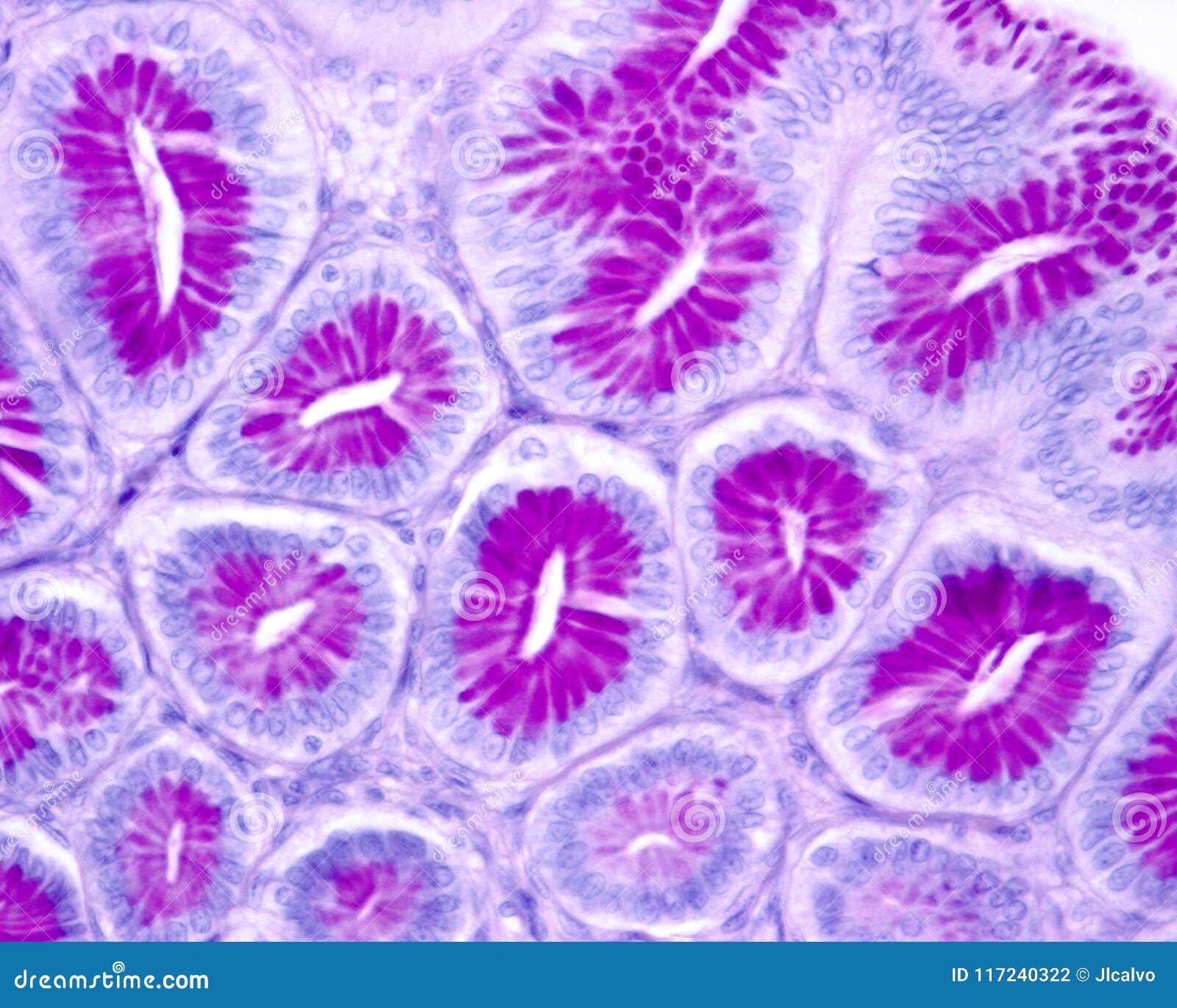 Gastric pits PAS stain stock photo Image of cell 
