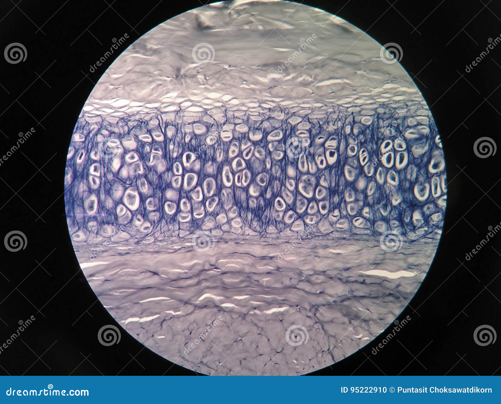 Cross Section Human Cartilage Bone Stock Photo Image of healthcare