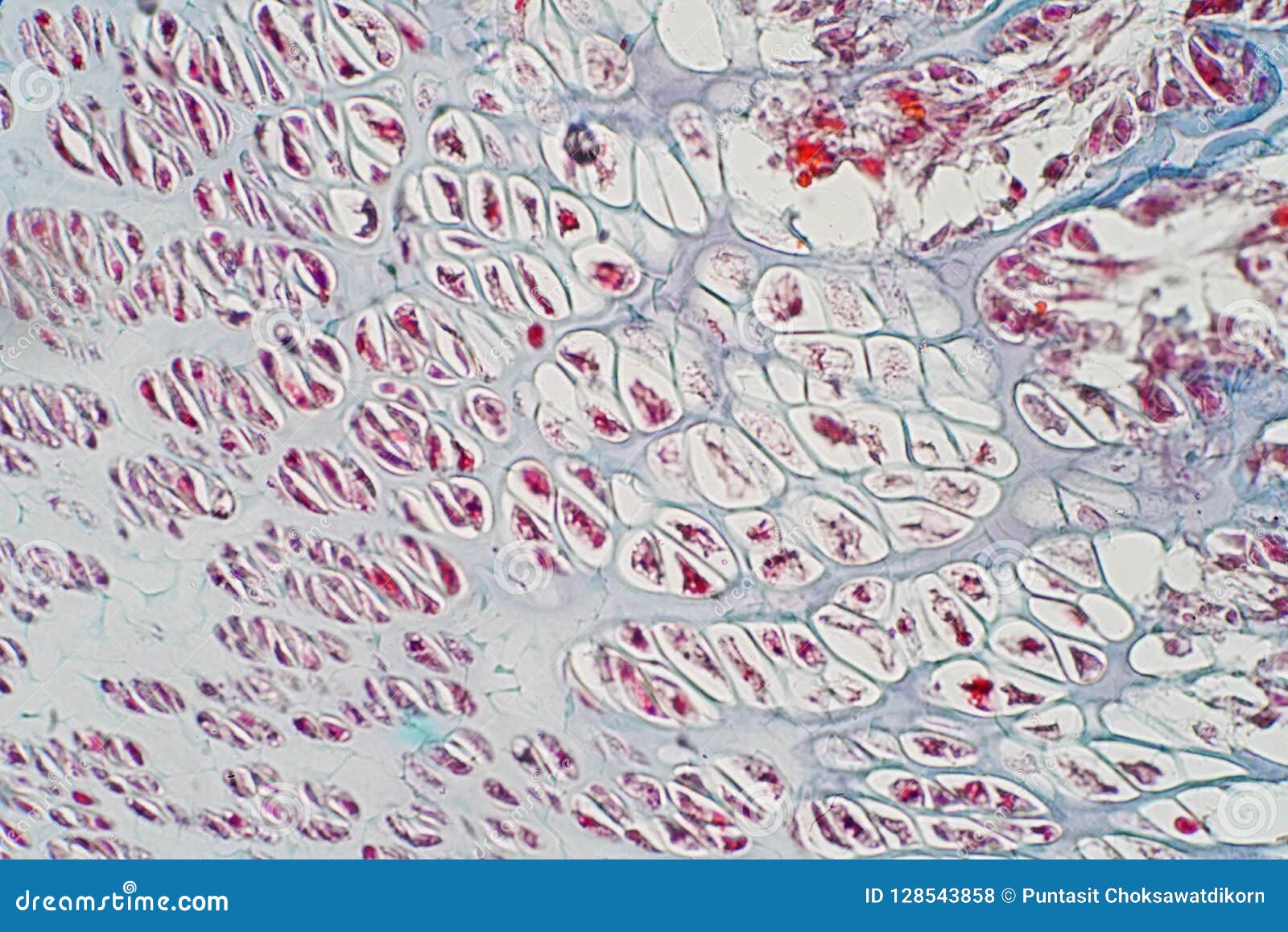 Cross Section Human Cartilage Bone Under Microscope View ...