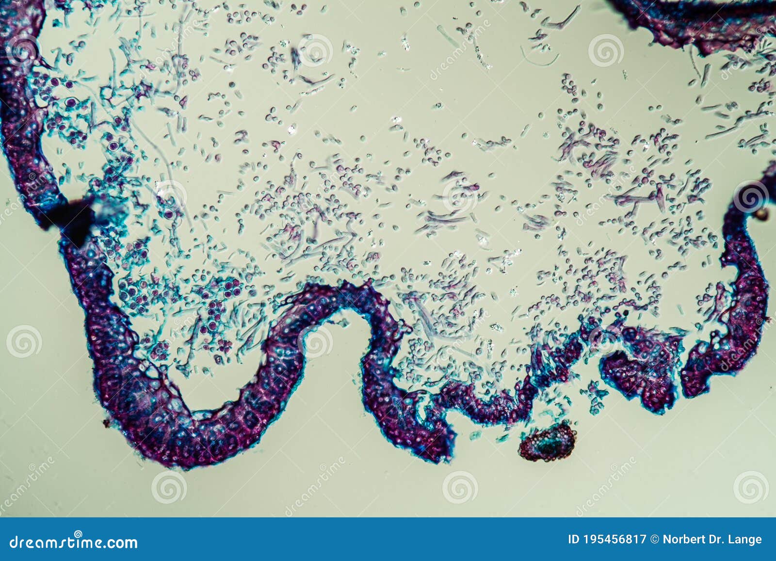 cross-section through the lichen symbiote body