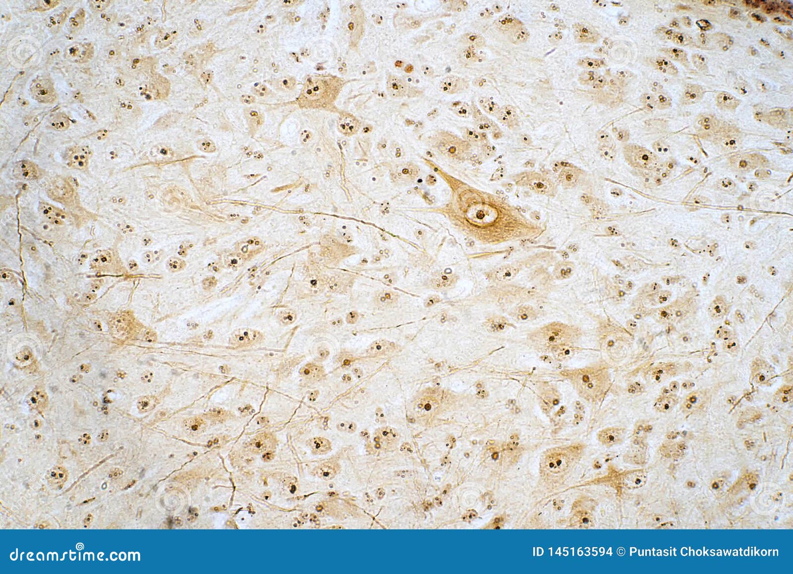 Cross Section Of Spinal Cord Under The Microscope View ...