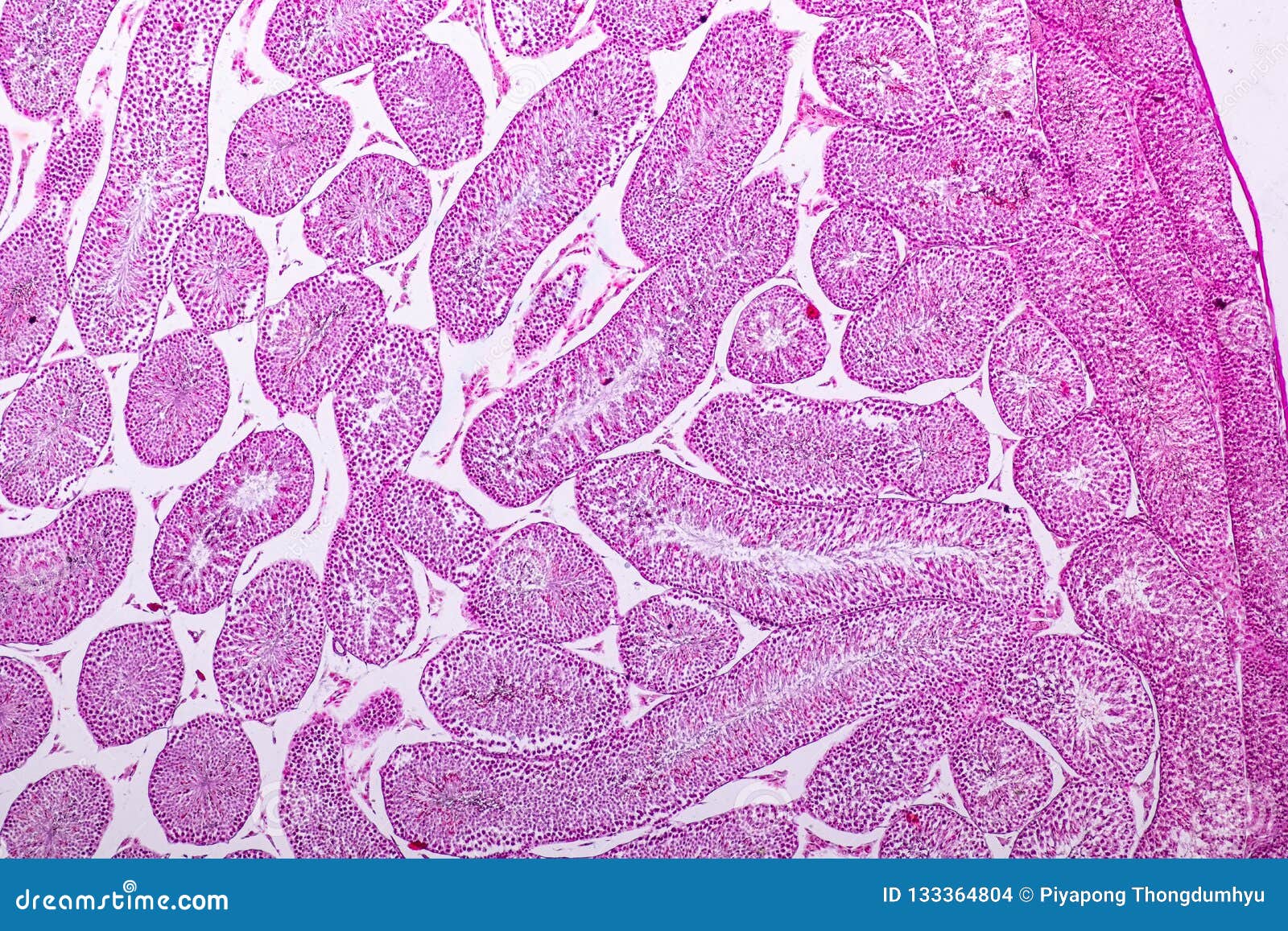 Testis Cross Section Anatomy