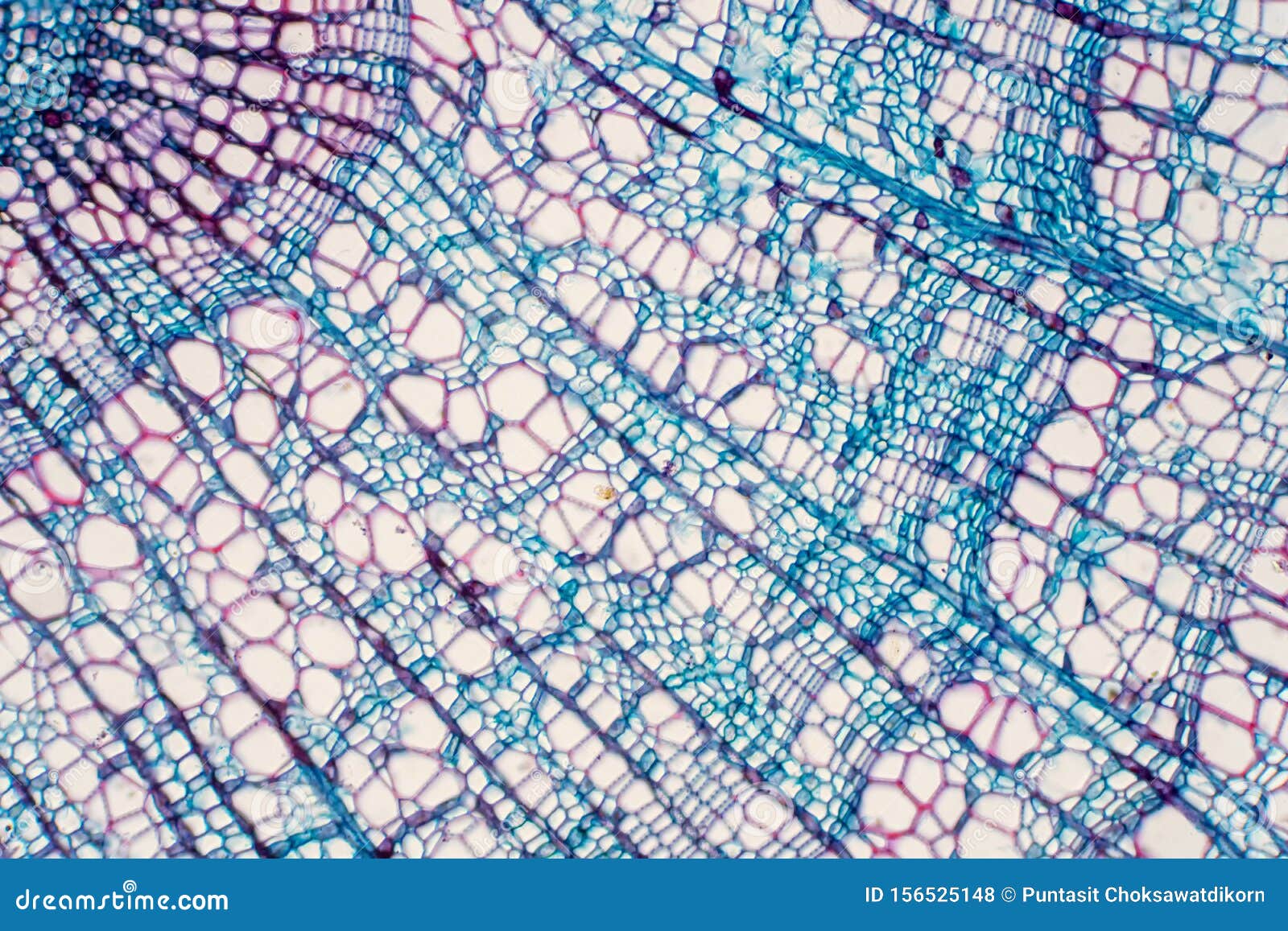 cross section - xylem is a type of tissue in vascular plants that transports water and some nutrients