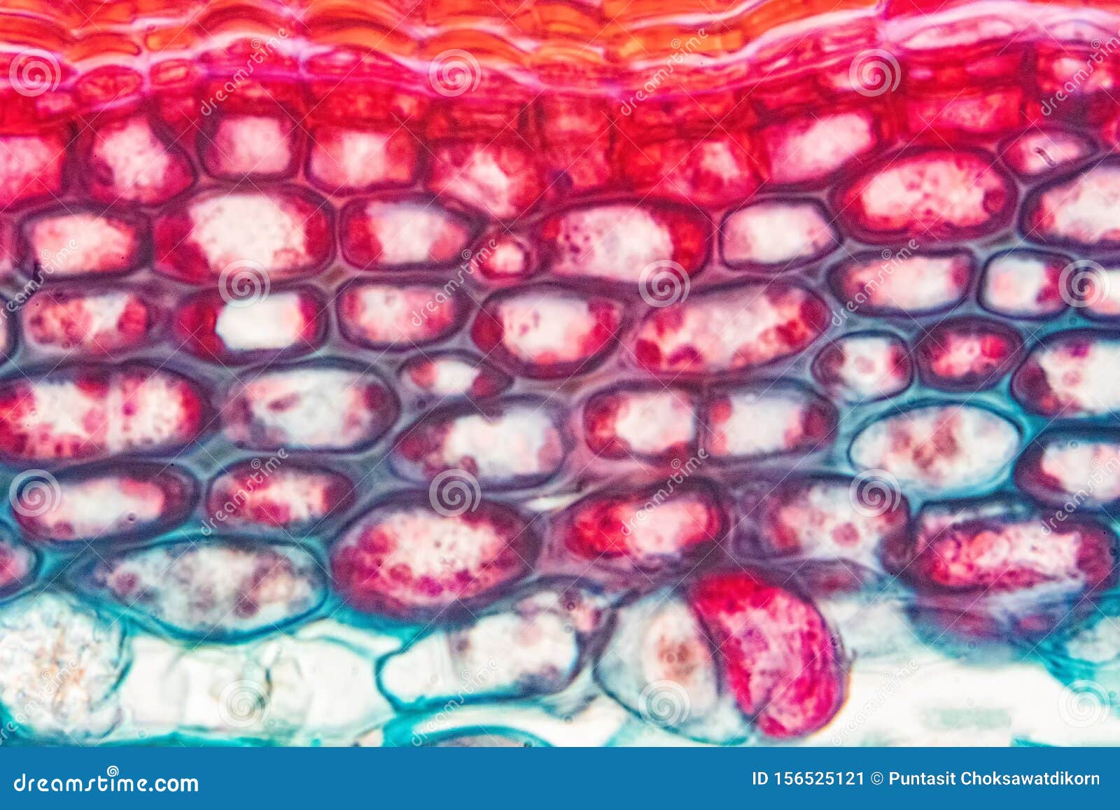 Sclerenchyma Tissue Under Microscope