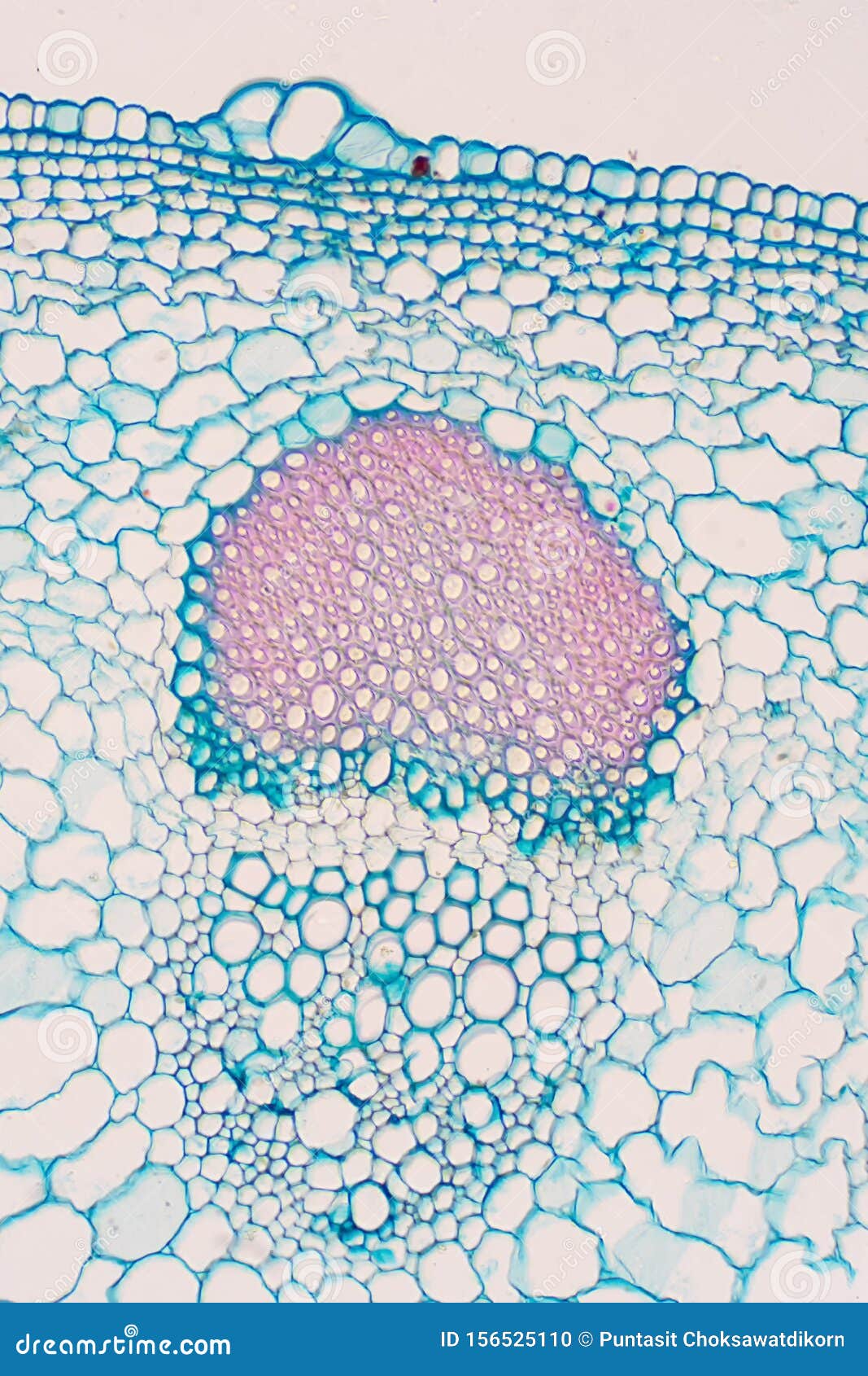 Cross Sections of Plants Stem Show Plant Vascular Tissue Under ...