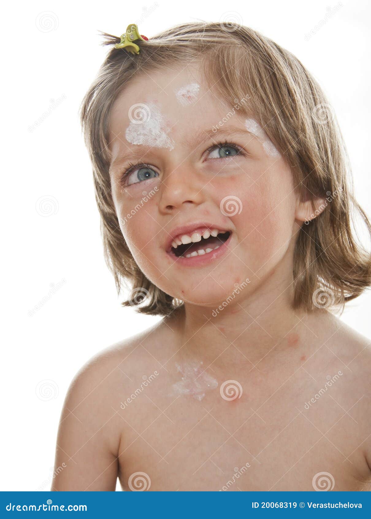 crying little girl with smallpox