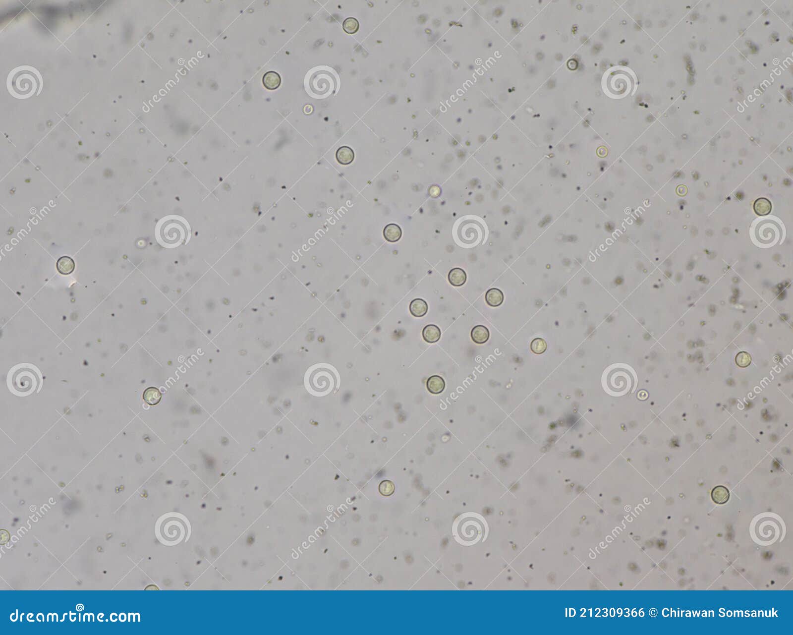 cryptococcus neoformans is an encapsulated yeast india ink preparetion