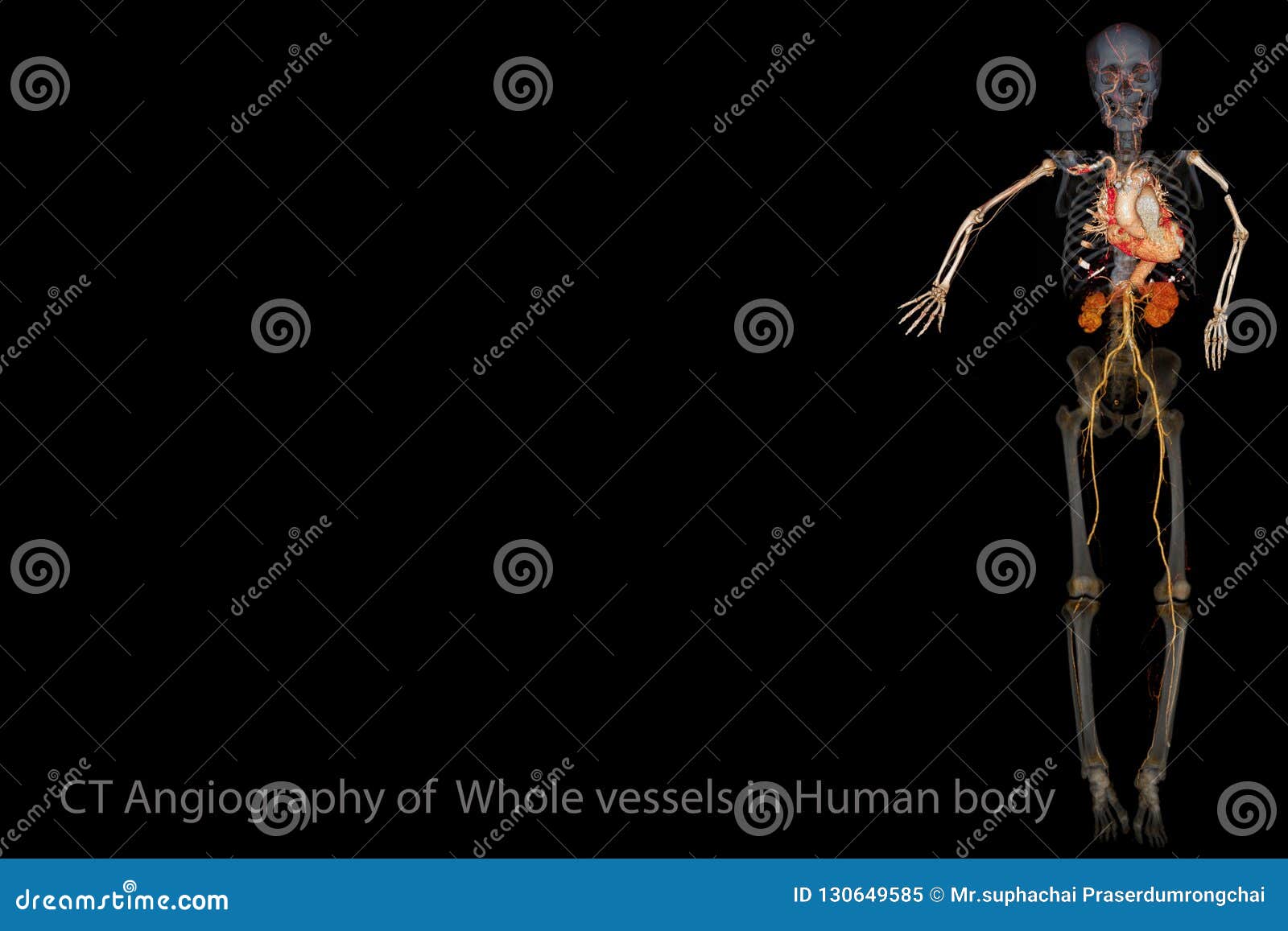 ct scan imaging 3d rendering image of whole vessels in human body.