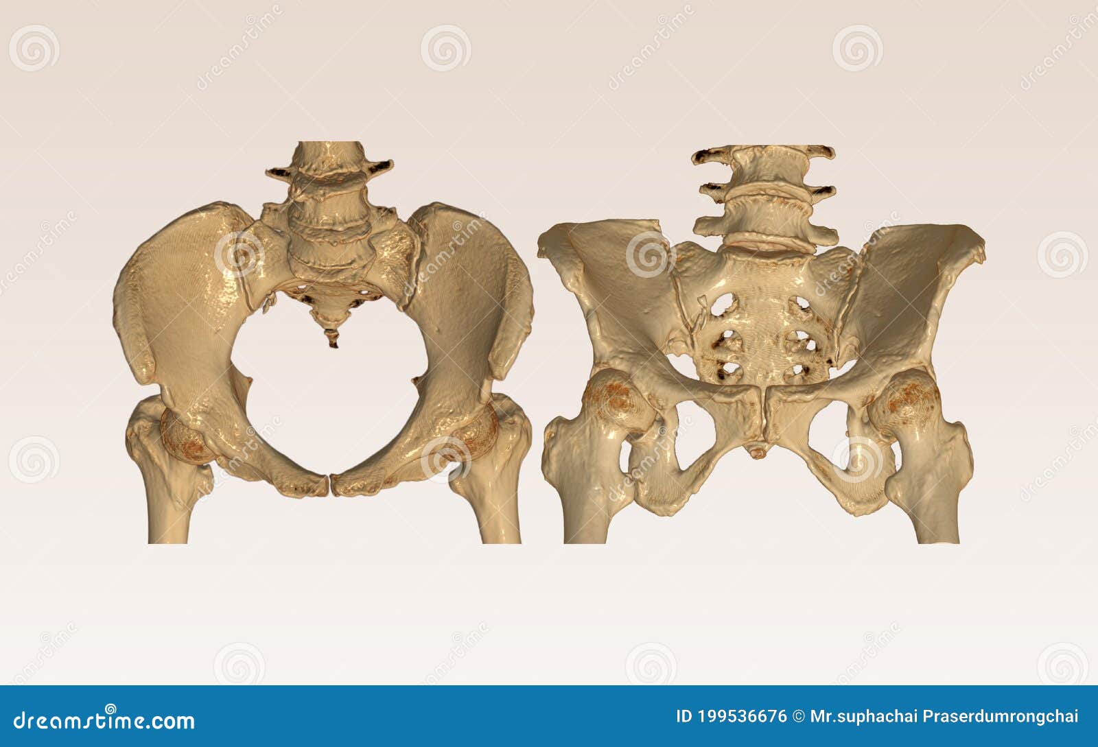 CT Scan of Pelvic Bone with Both Hip Joint 3D Rendering Image Inlet and Outlet  View Stock Illustration - Illustration of diagnostic, pain: 199536676