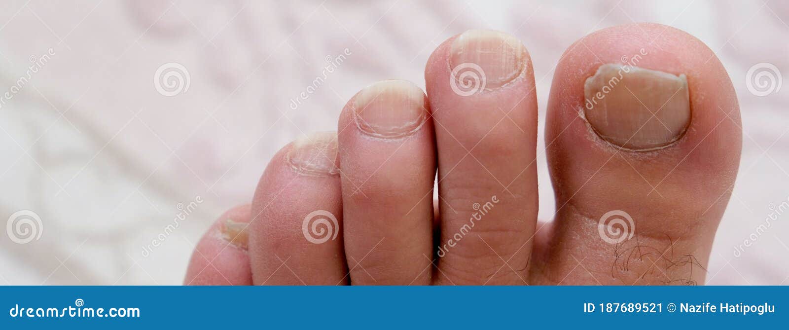 Cómo cuidar las uñas de los pies  6 pasos