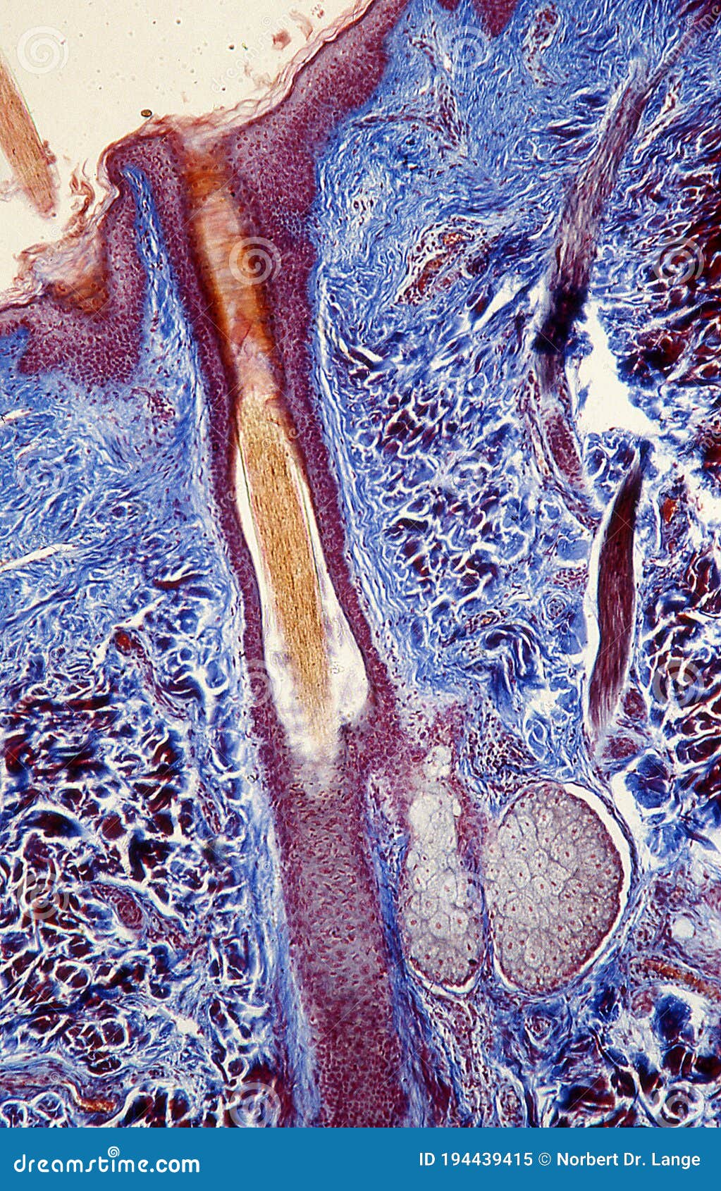 Cuir Chevelu Avec Une Chevelure Sous Le Microscope Image stock Image
