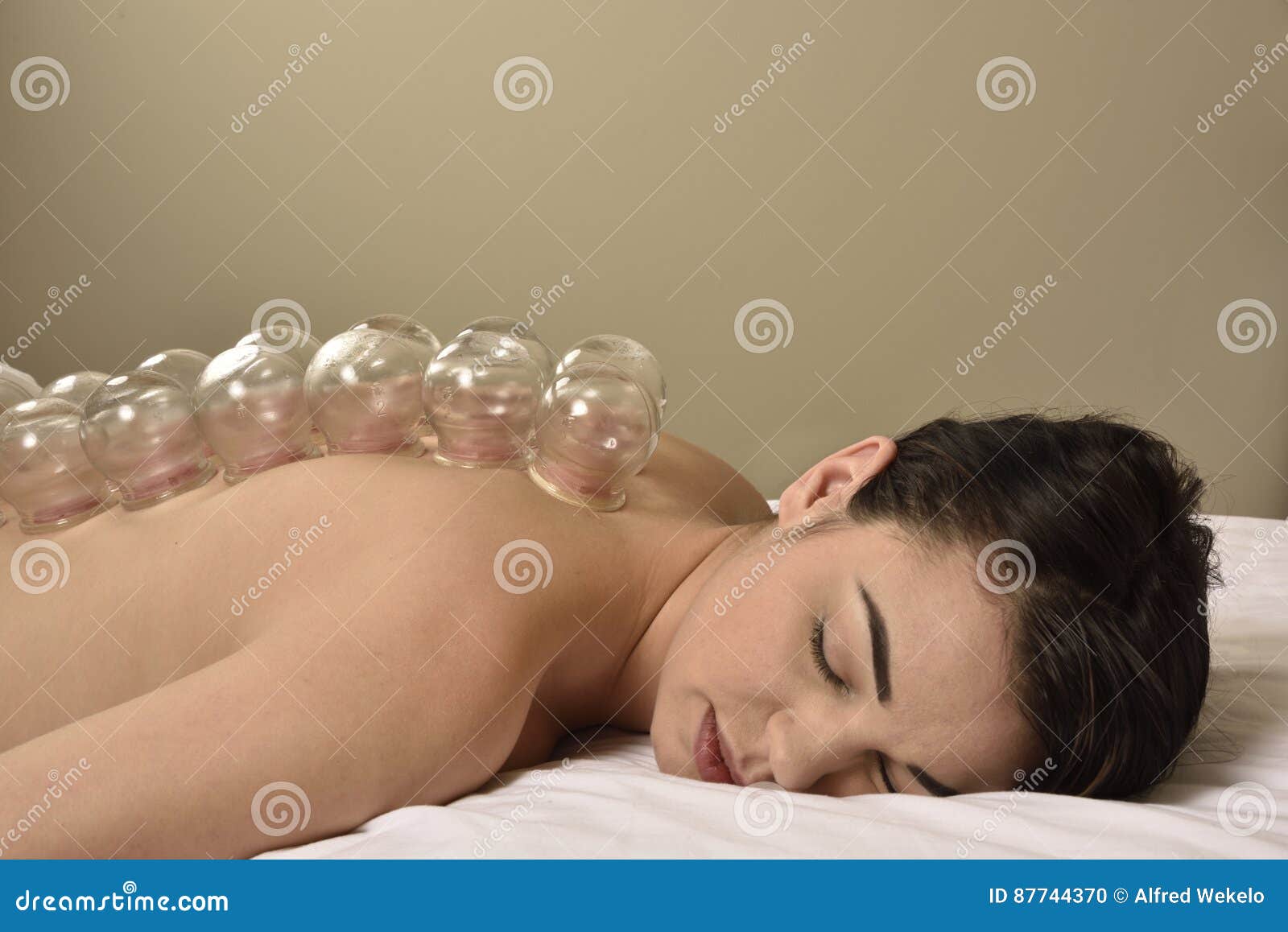 Cupping Side View Chinese Medicine Stock Photo - Image of ...
