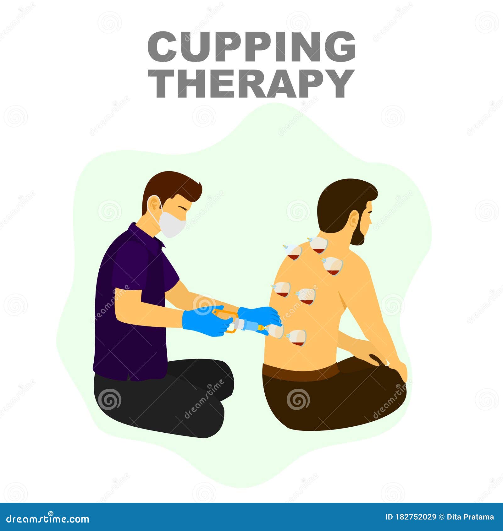 cupping therapy alternative medicine treatment, therapist puts a cup on skin .