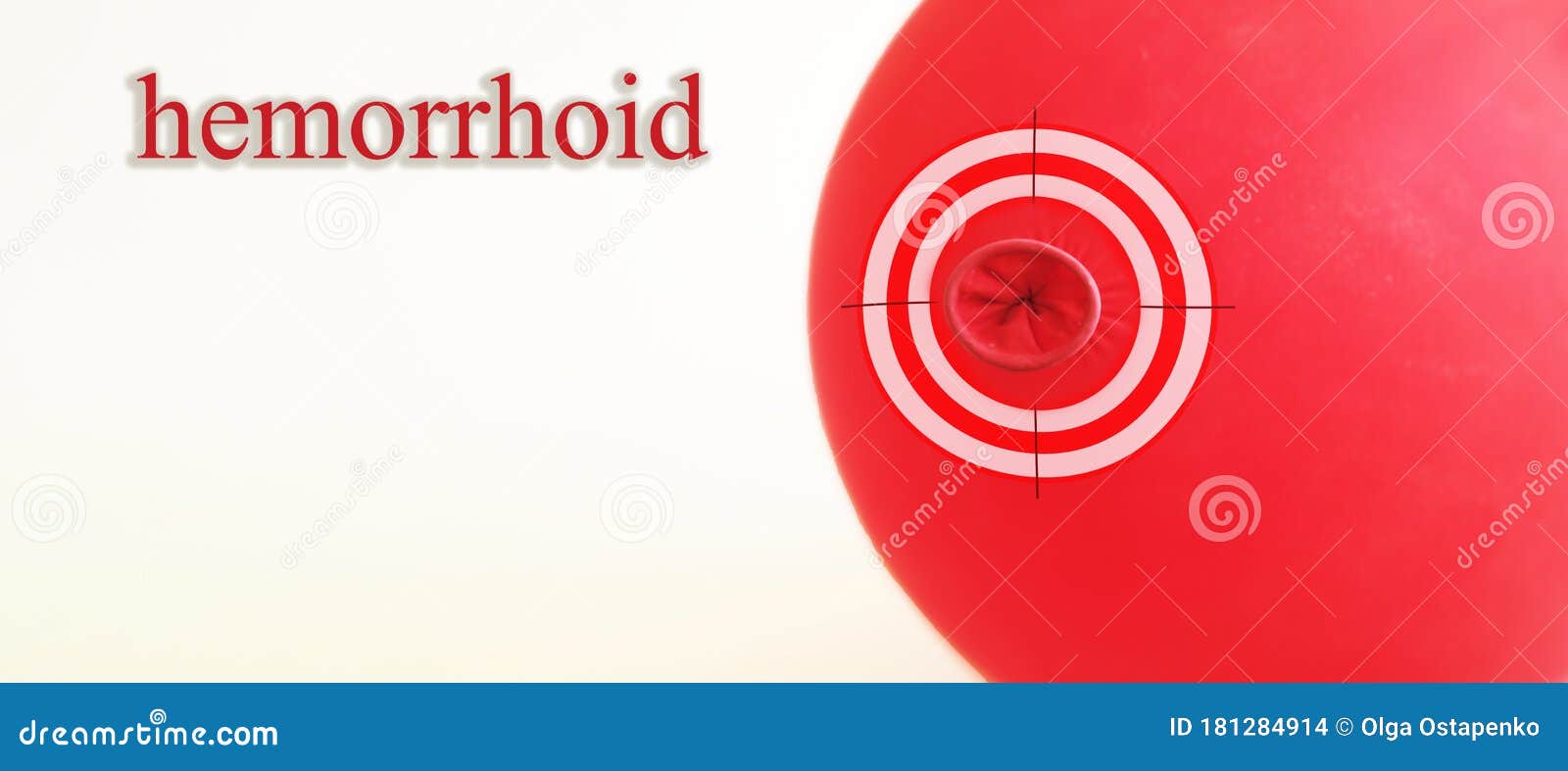 The Cure for Hemorrhoids Hits Exactly on Target. Hemorrhoid Treatment
