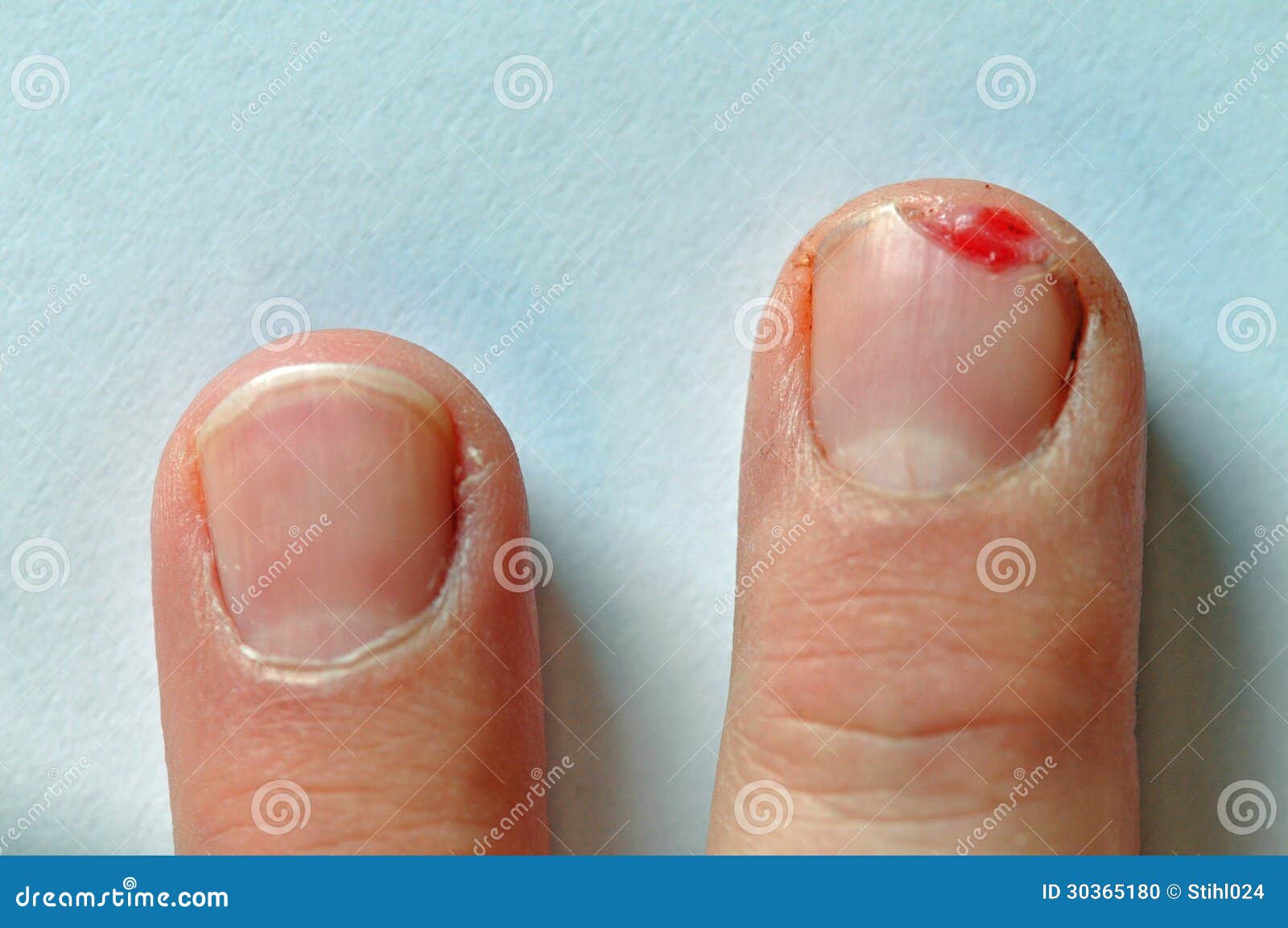 Paper Cut With Blood Stock Photo - Download Image Now - Paper Cut - Wound,  Blood, Body Care - iStock