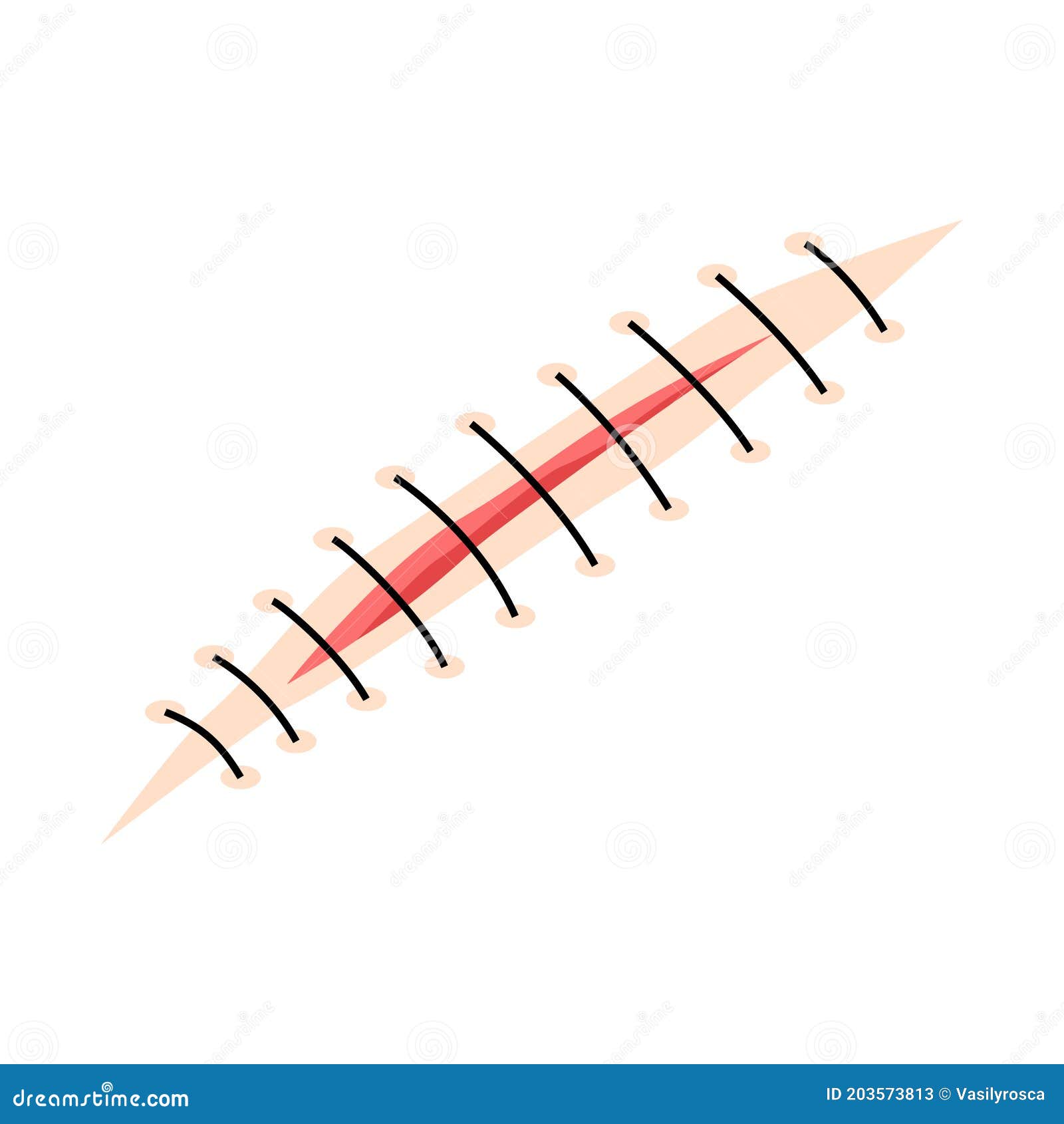 Wound And Scar. Cartoon Vector | CartoonDealer.com #29825829