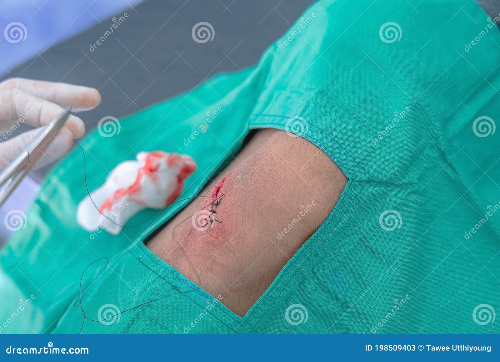 Cut wound dressing stock image. Image of injury, knee 198509403