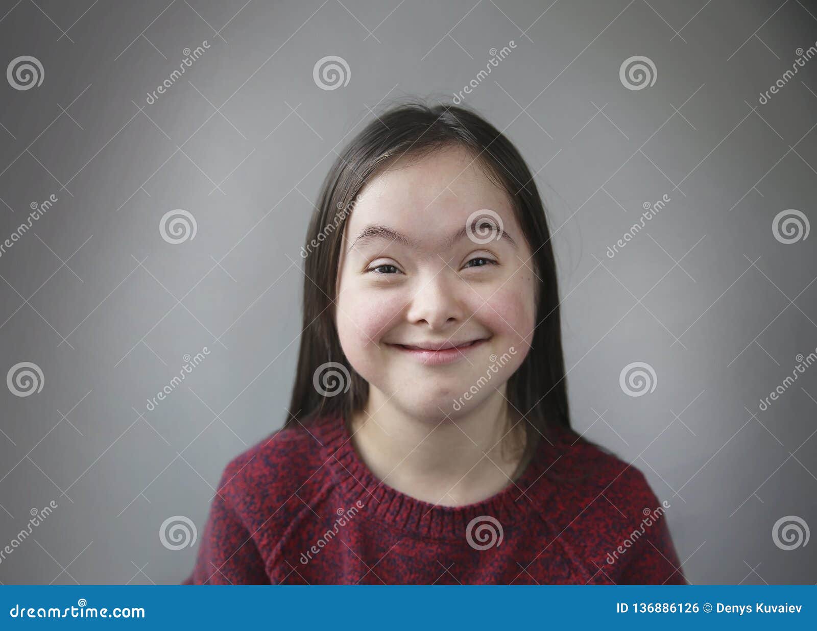 Cute Smiling Down Syndrome Girl Stock Photo Image Of Copy Mental