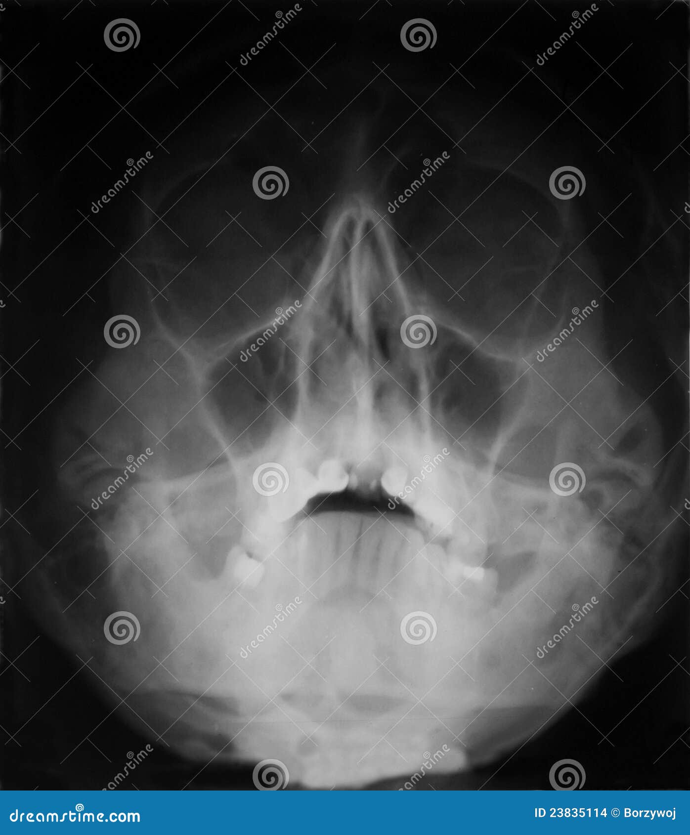 Frontowy ludzki fotografii czaszki xray