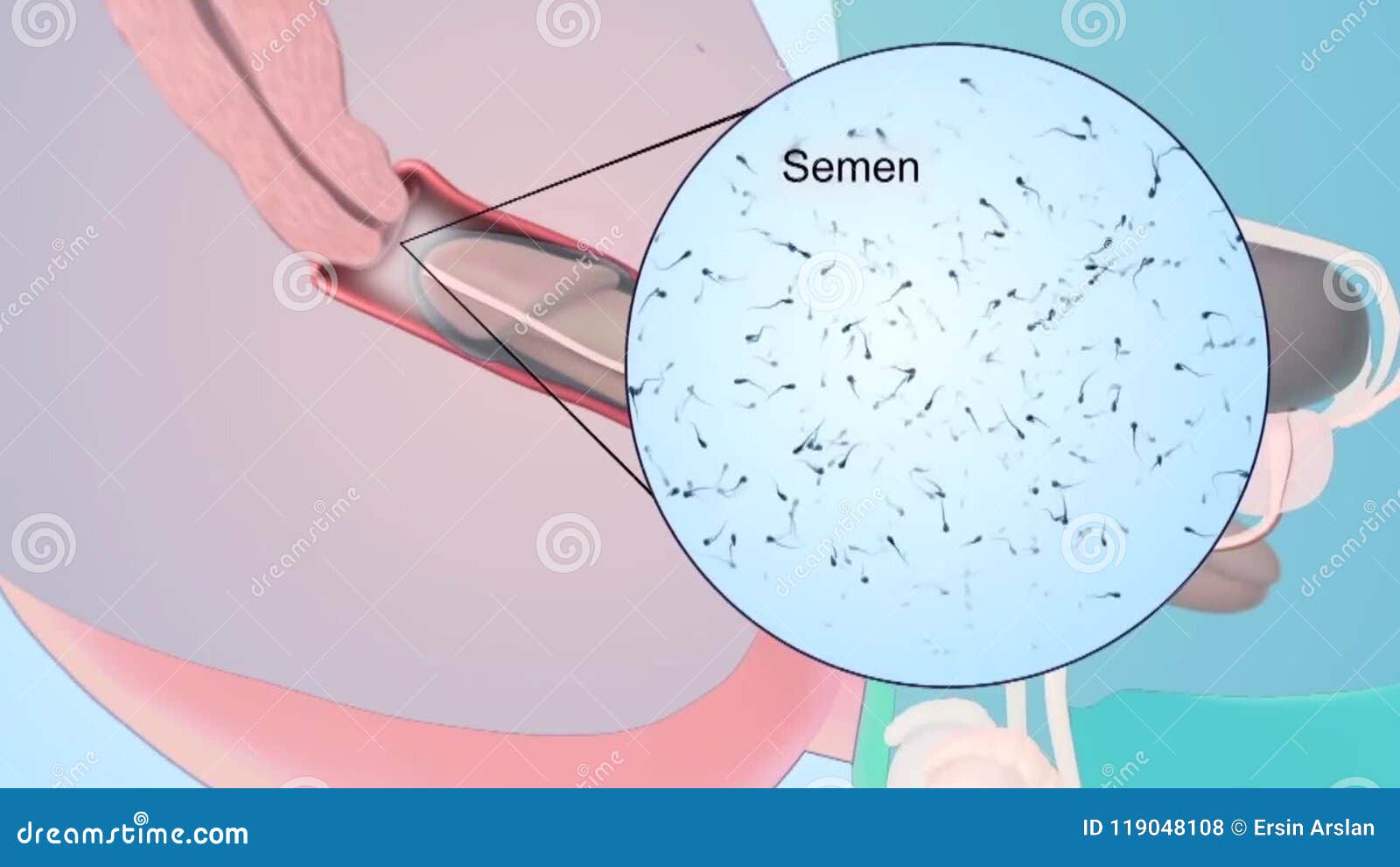 Male ejaculation by anal stimulation