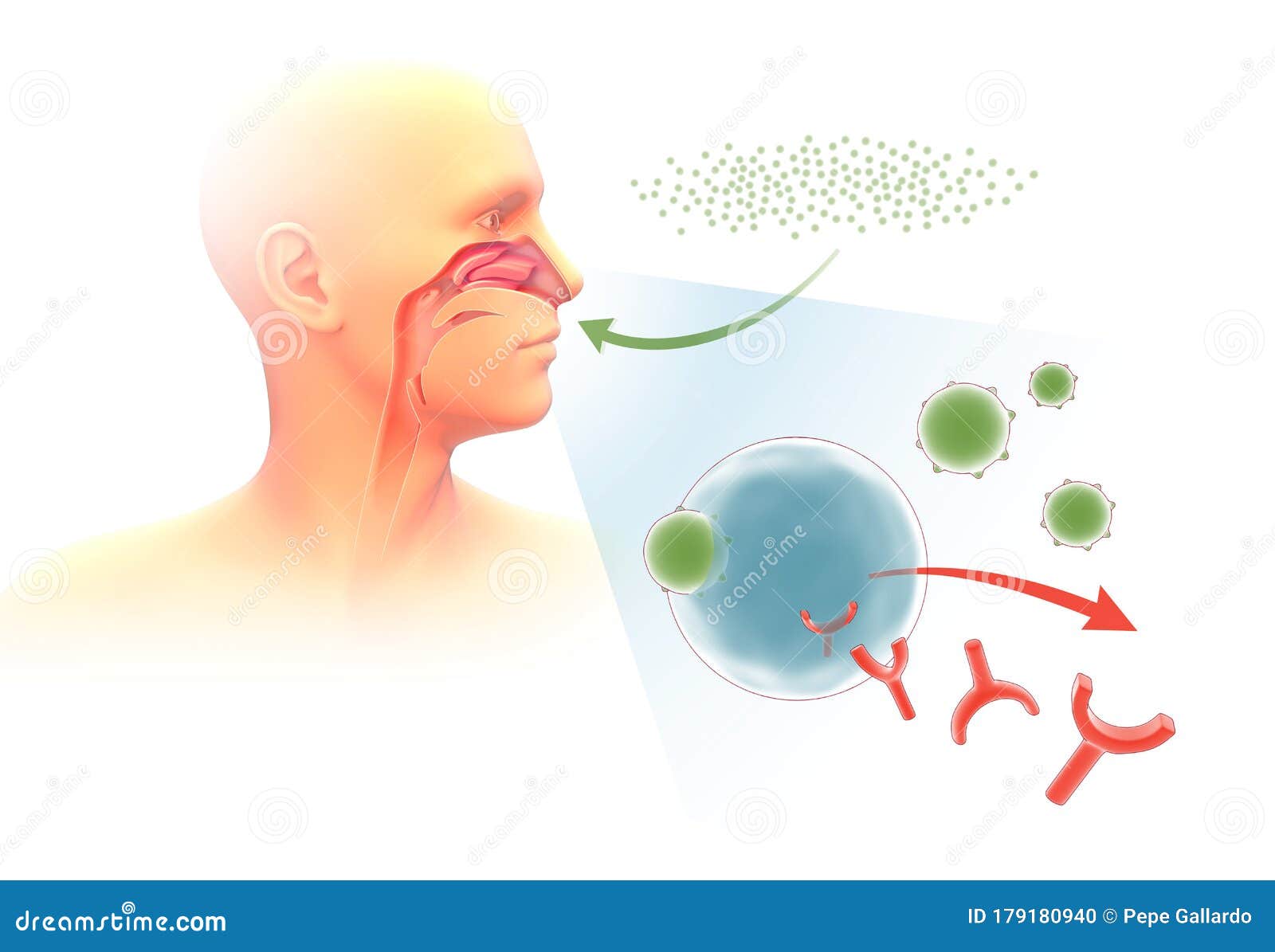 3d Illustration Depicting the Mechanism of Allergy in the Respiratory
